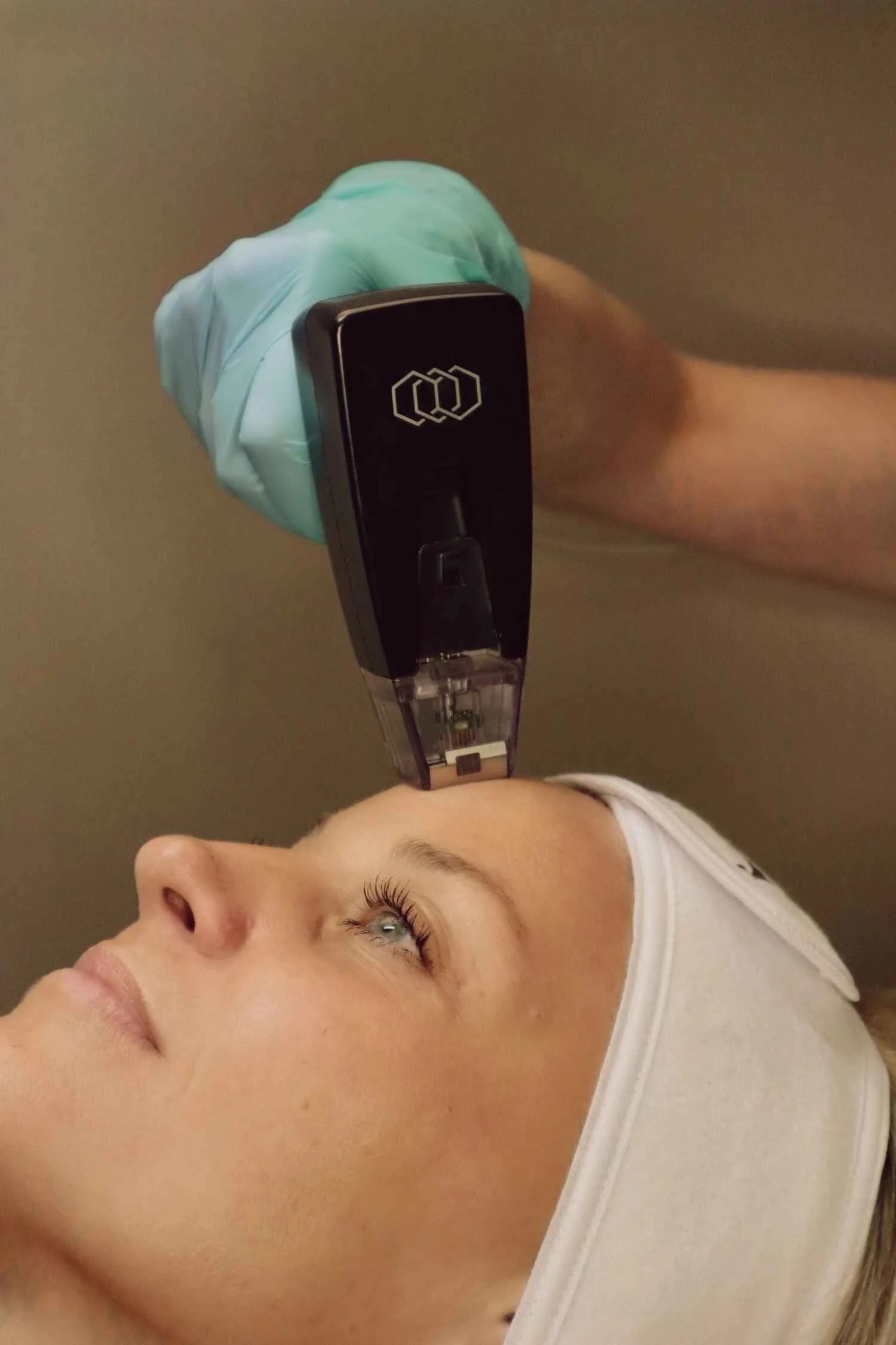 Patient receiving a Morpheus8 microneedling skin rejuvenation treatment at Amavi Aesthetic Surgery in Denver, CO