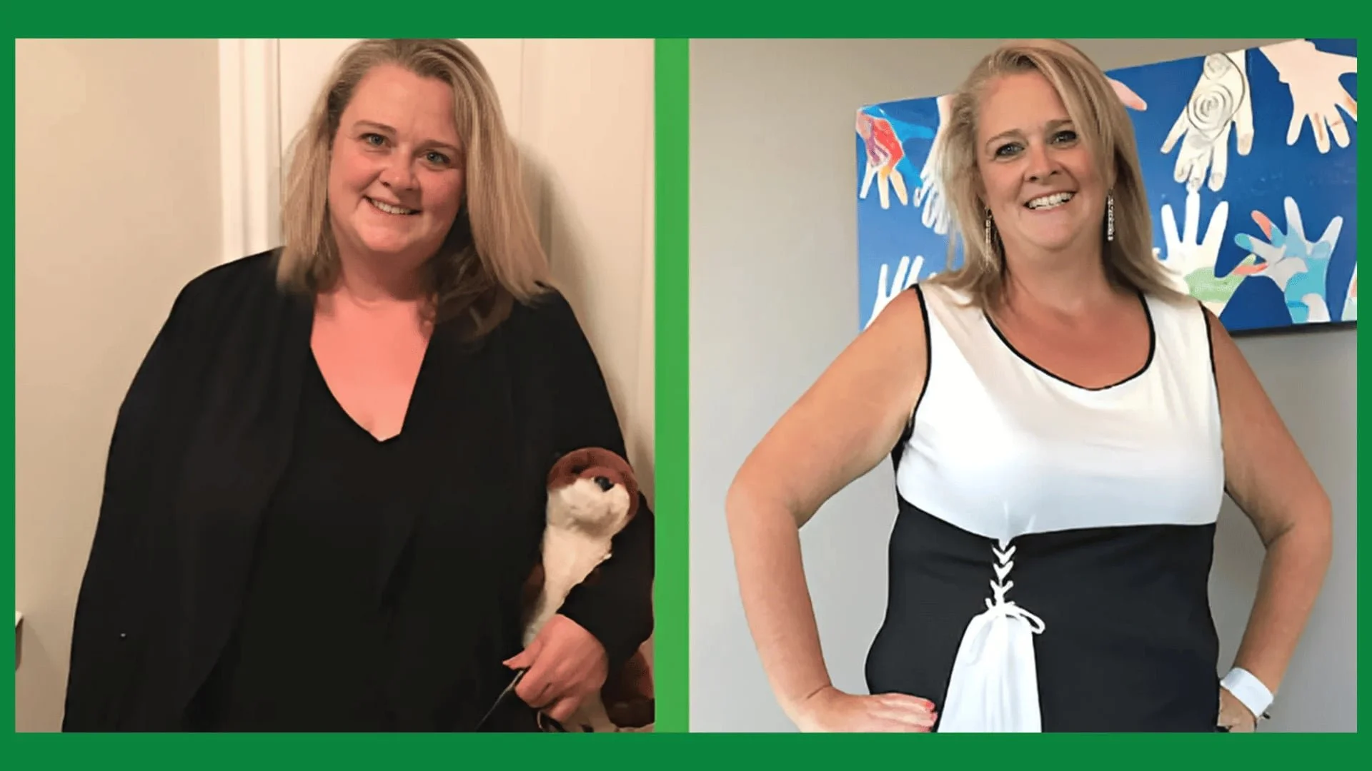 Side-by-side photos of the same woman before and after weight loss. In the 'before' photo, she is wearing a black outfit, smiling, and holding a stuffed animal. In the 'after' photo, she is wearing a white and black dress with her hand on her hip, smiling, with a colorful abstract painting in the background.