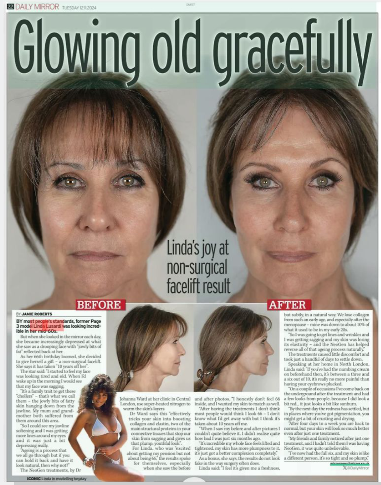Daily Mirror article about Linda Lusardi 'glowing old gracefully' and her use of Neogen Plasma