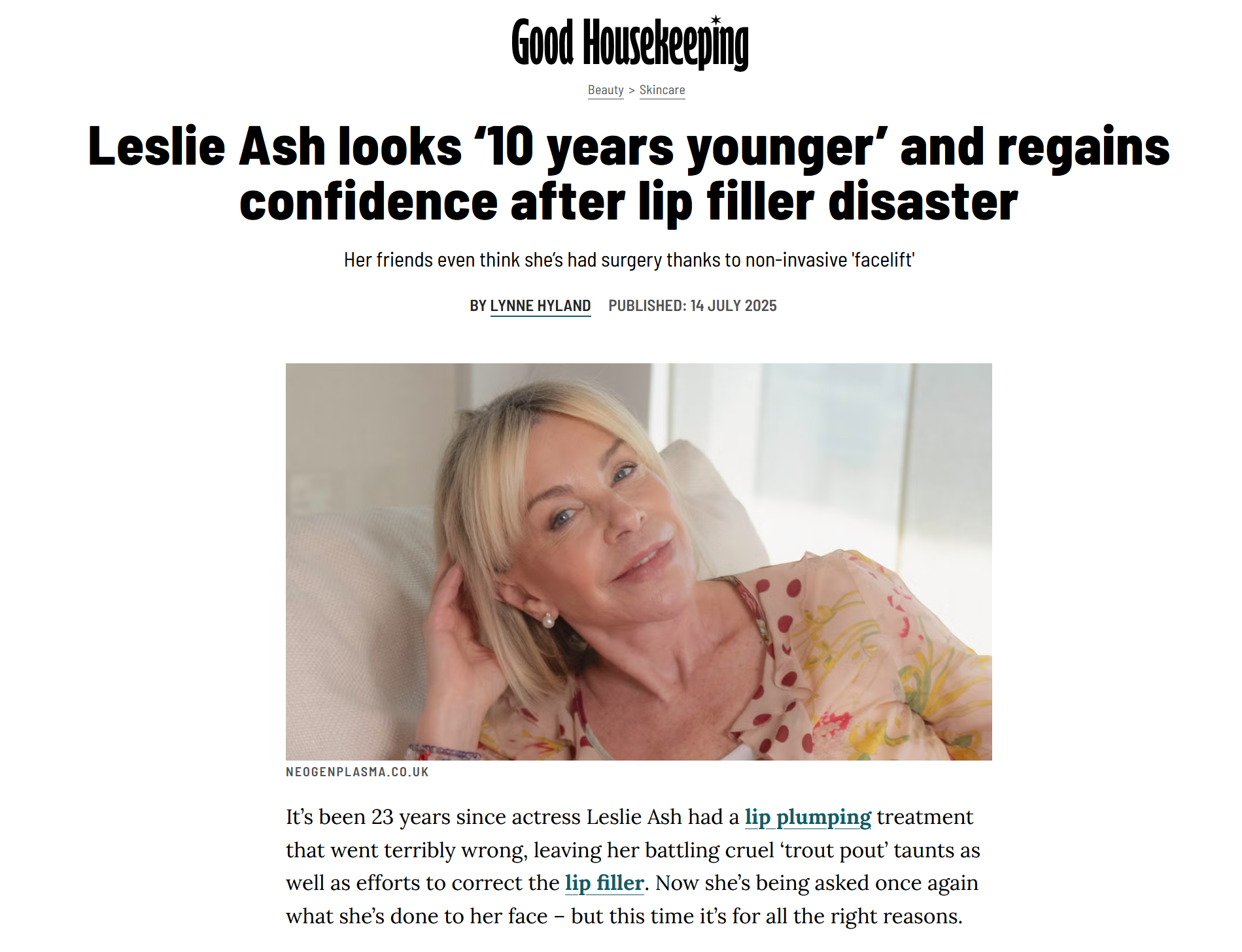 Interview with Leslie Ash in Good Housekeeping about how Neogen Plasma helped her regain her confidence after her previous lip filler disaster