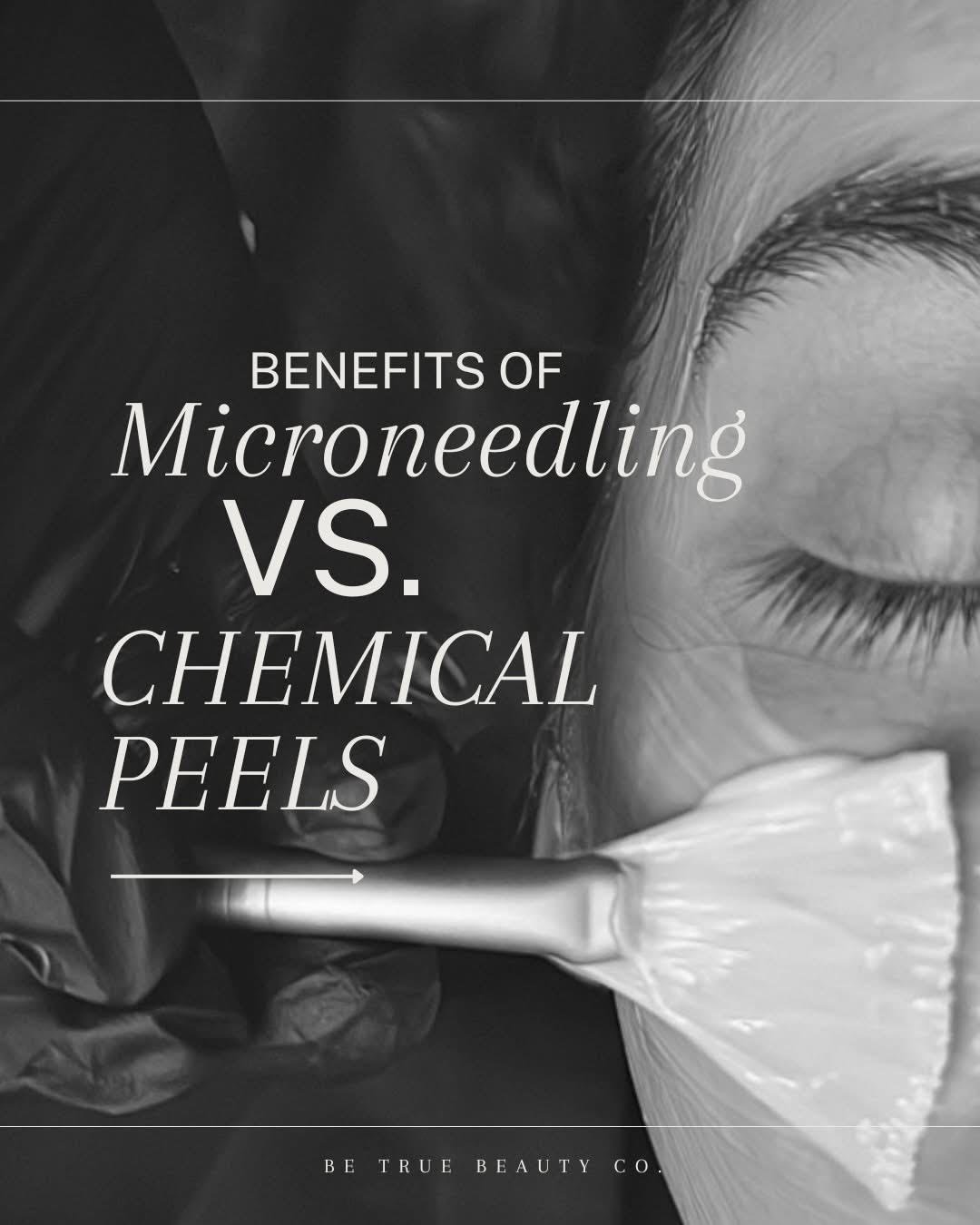 Microneedling vs. Chemical Peels: Which Treatment is Right for Your Skin?