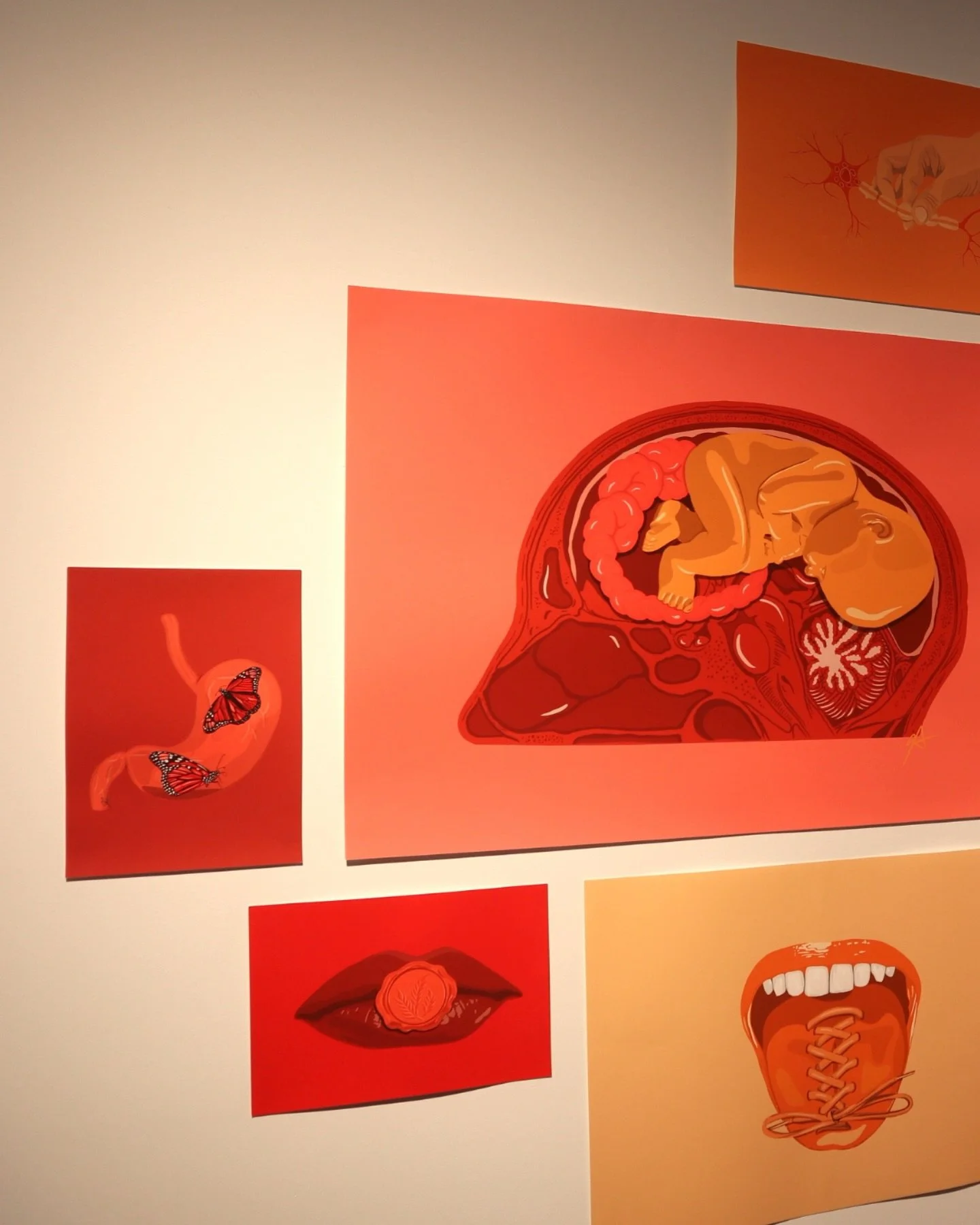 And that&rsquo;s a wrap!

My first official solo exhibition, Not So Grey Anatomy, at @stvincentsmelbourne was a career highlight I will remember! The feedback from staff, visitors, and patients was phenomenal. To have a space such as this for people 