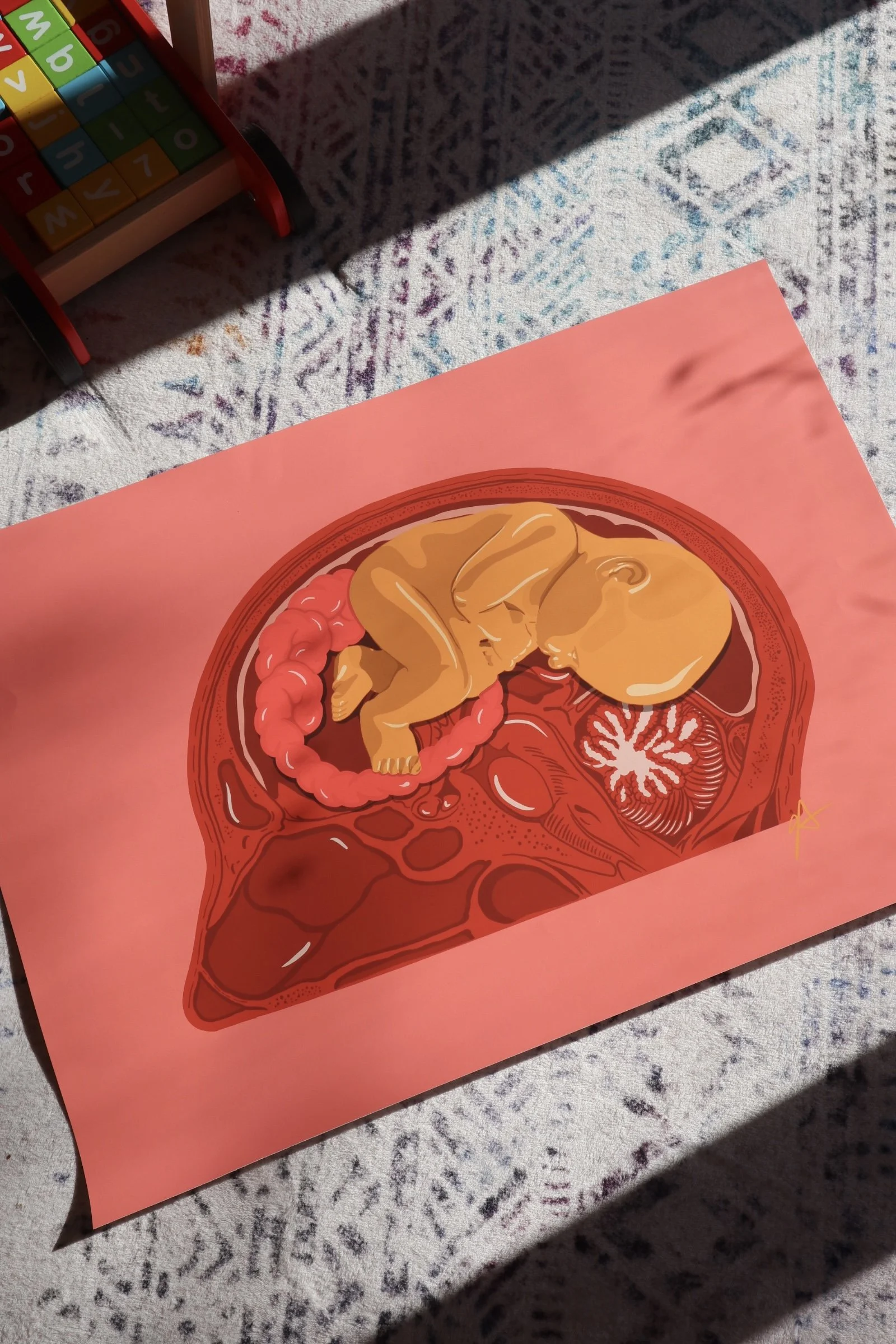 One of a kind Print | Baby Brain | A1