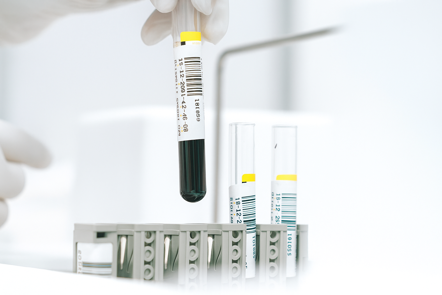 bloodtest-vitamin-analysis