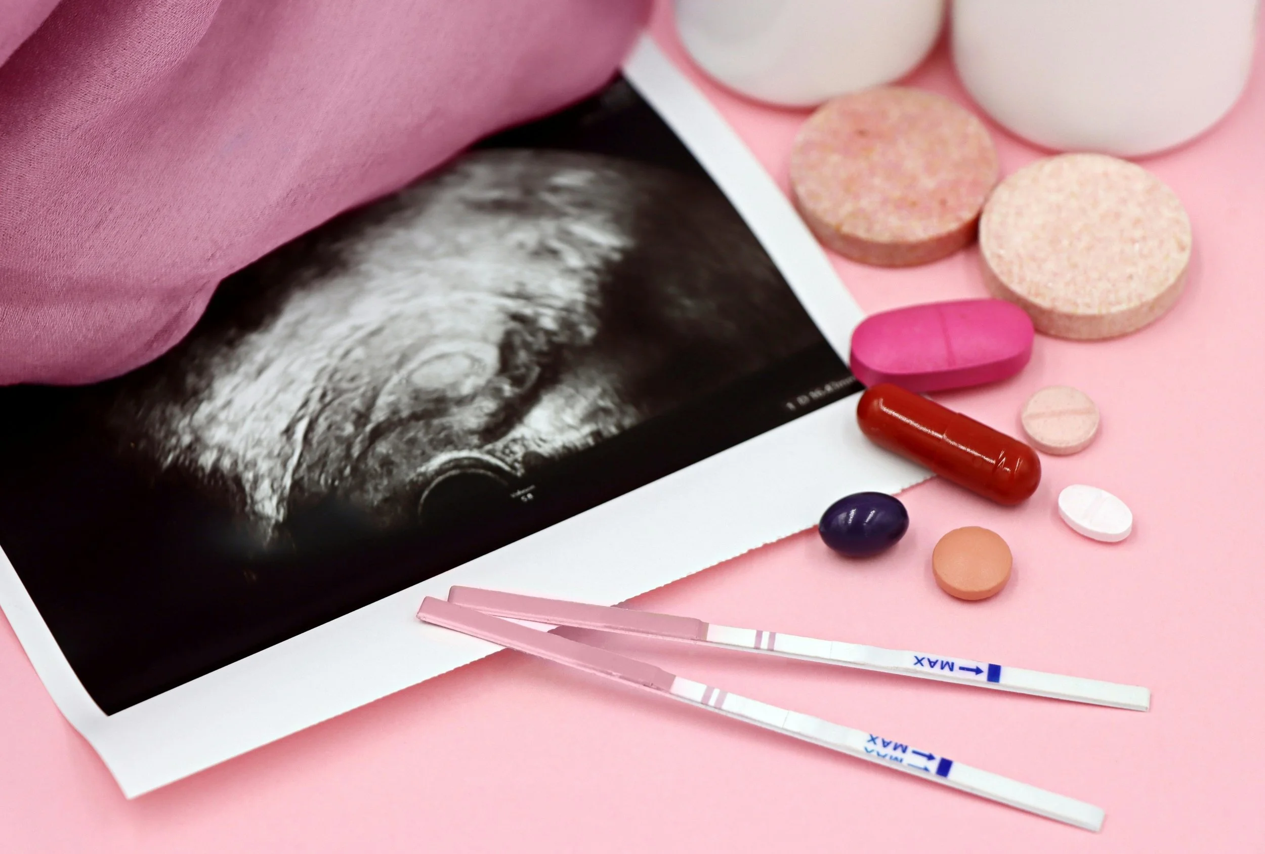 When All Your Tests Are "Normal": Decoding Unexplained Infertility