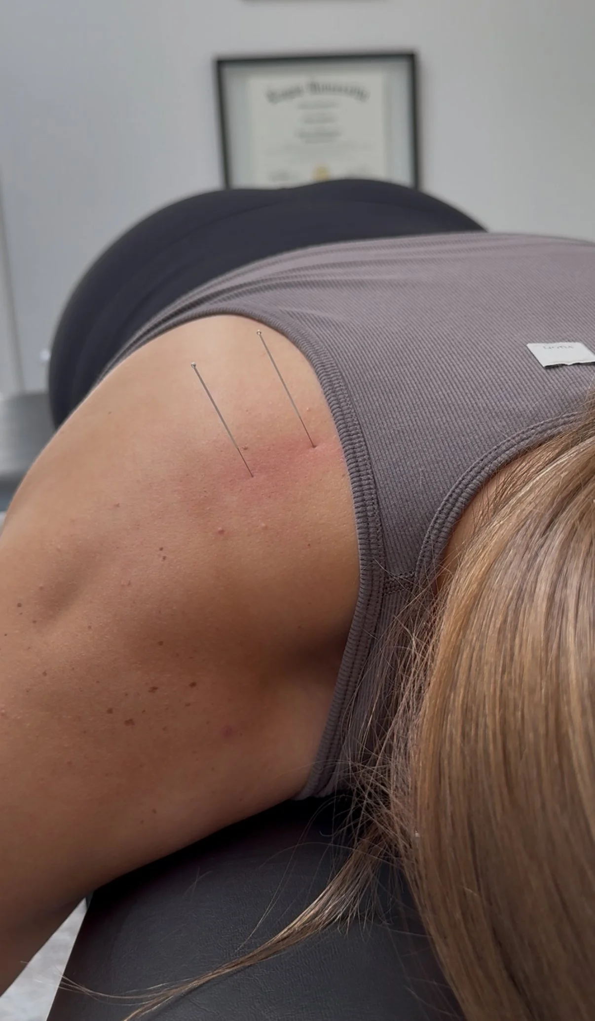 Sore Neck After Chiropractor: Why It Happens, When to Worry, and How Your Body Heals