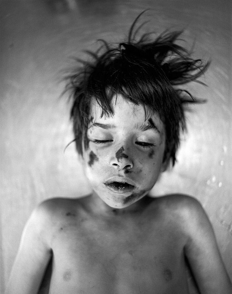 Boy Hit by Car, 1973