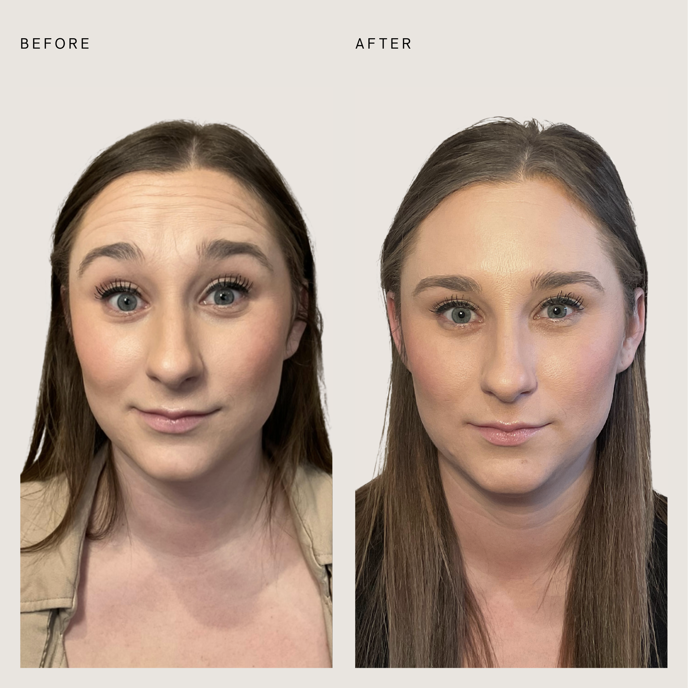 wrinkle relaxer_02 copy.png