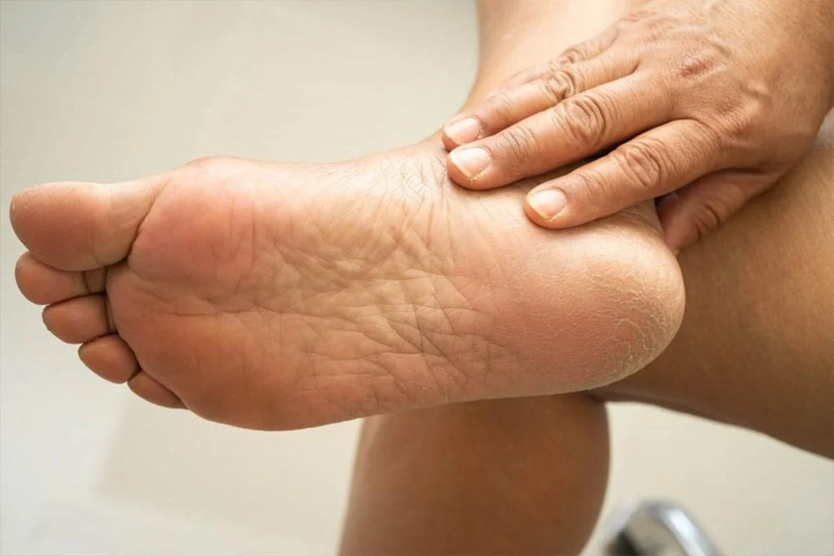 Why You Should Check Your Feet Every Day If You Have Diabetes