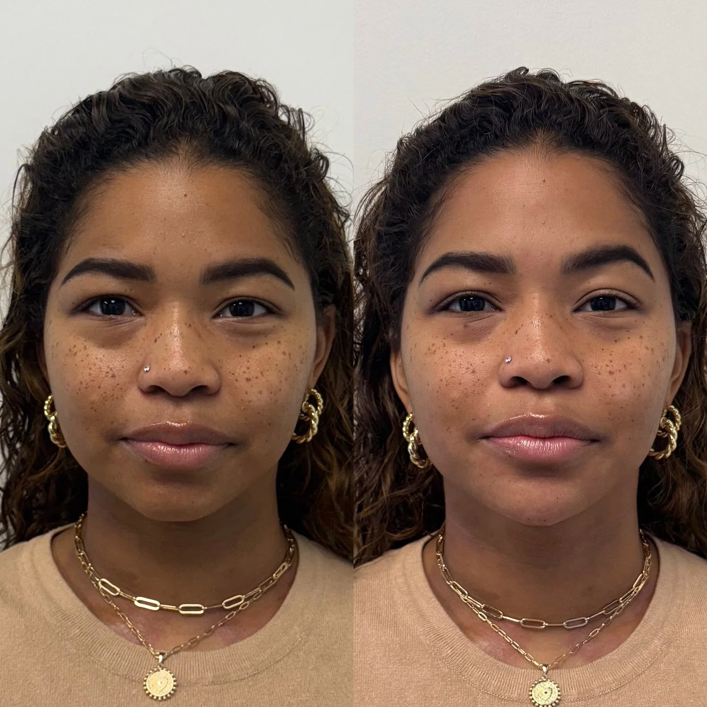 Training tip that I&rsquo;ve carried with me throughout the years: aging is often about shadows.

Our eyes pick up on dark areas as &ldquo;tired&rdquo; or &ldquo;aged,&rdquo; while light is associated with youth and vitality.

For this already beauti