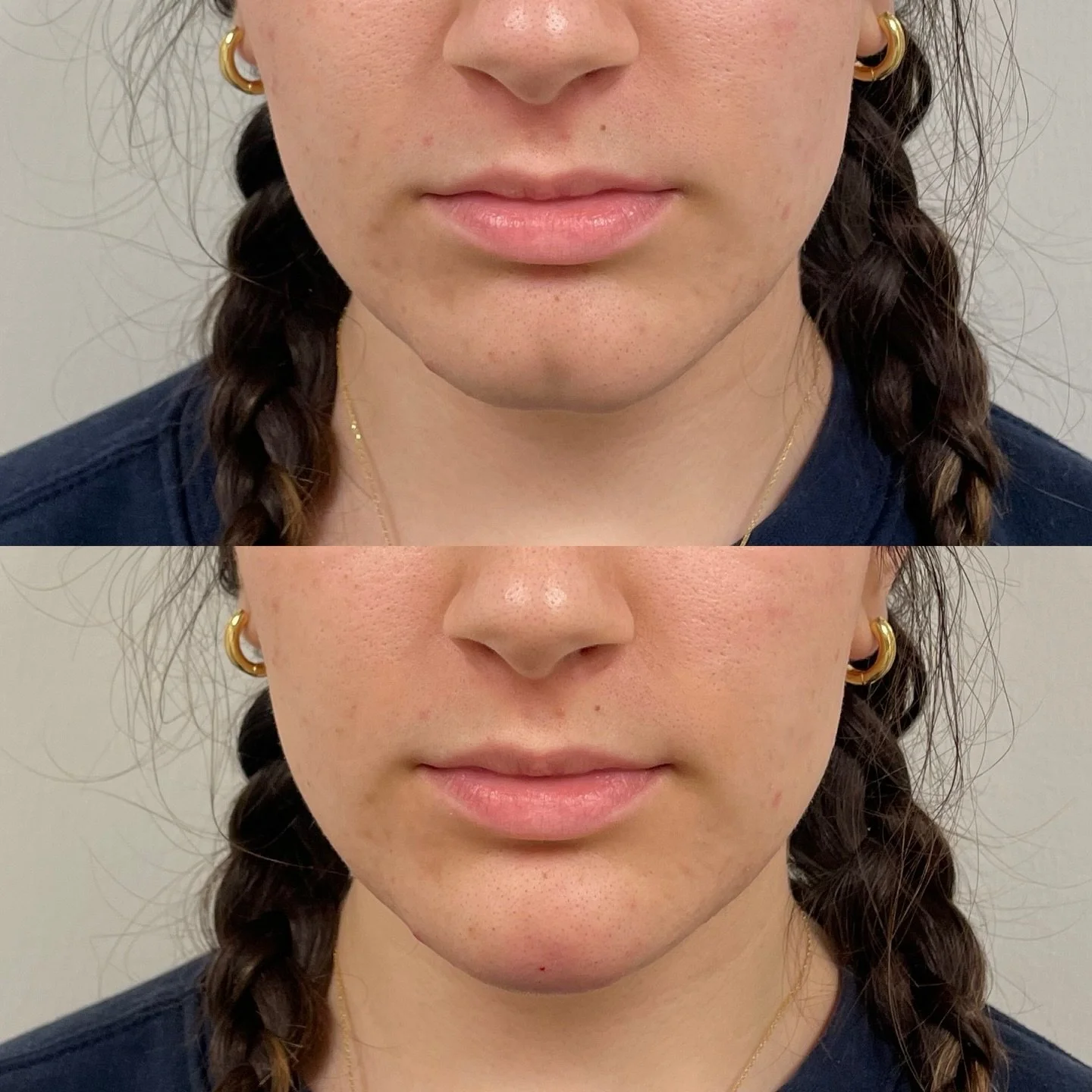 Being able to help correct an insecurity someone has had their entire life is what drives me to do better in this aesthetic field. 

When you cry happy tears, I cry tears of joy with you. 

I&rsquo;m thankful for each and every one of you for trustin