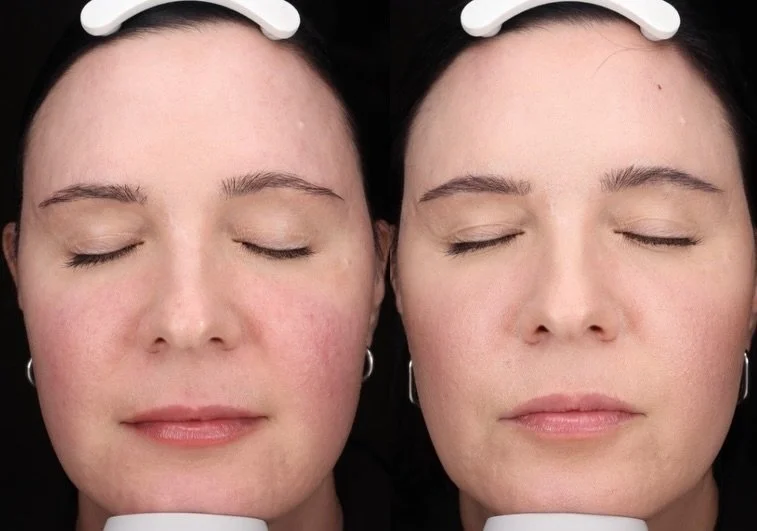 SkinBetter Mystro.

No lasers, no treatments, just skincare🤯