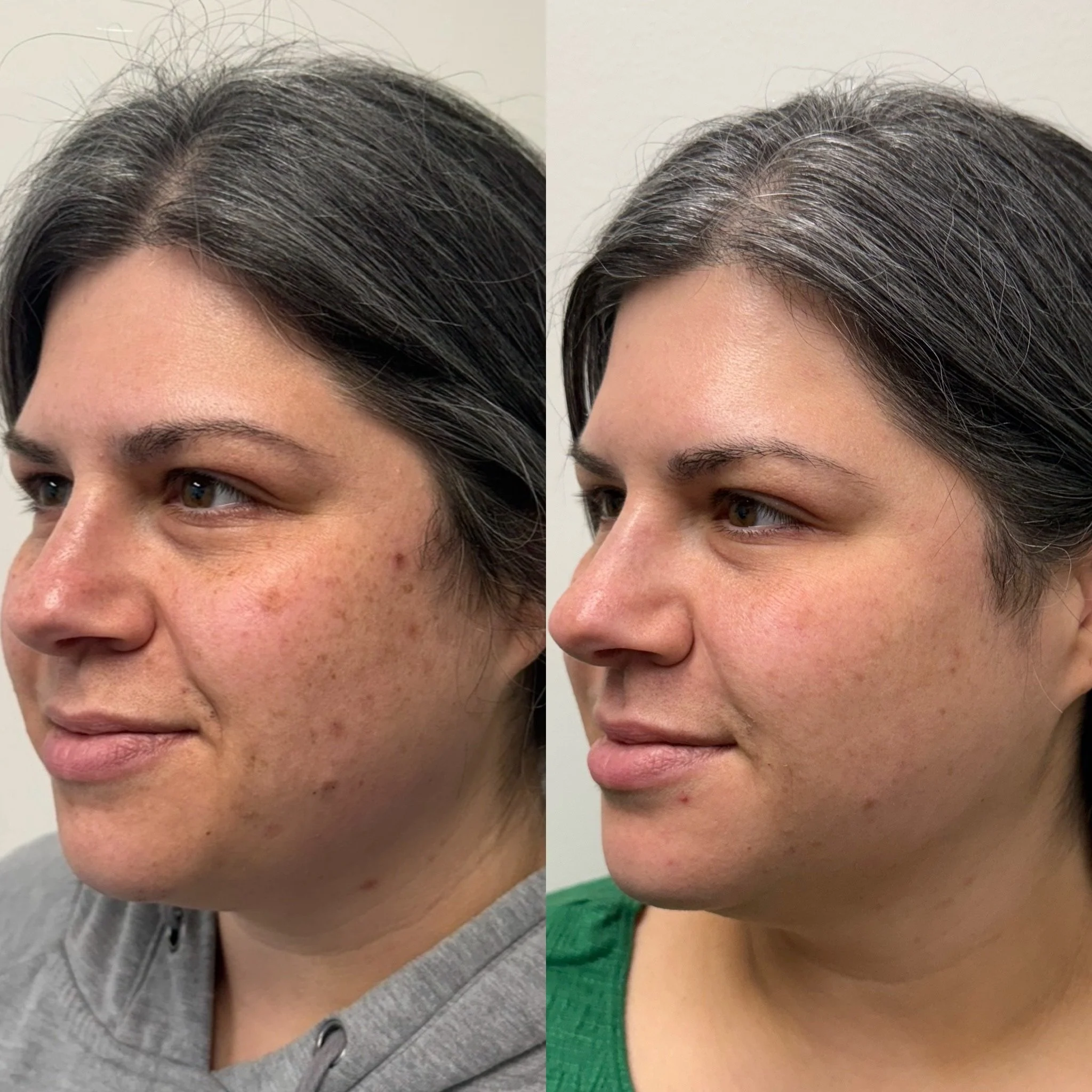 Krysti Loftis LASER Transformation.JPG