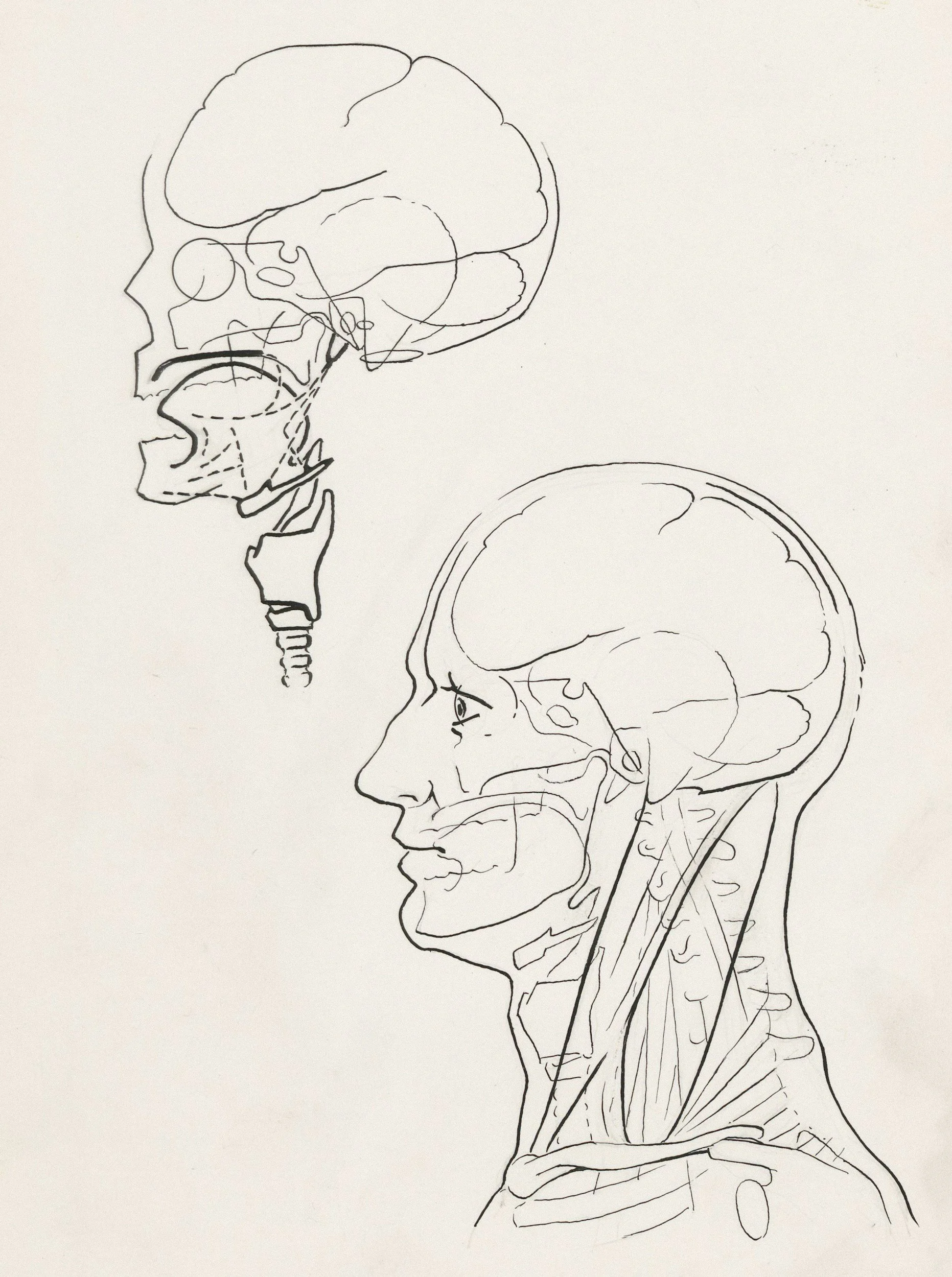 Trigeminal Nerve Pain - Migraine and Upper Cervical Vertebrae Involvement.