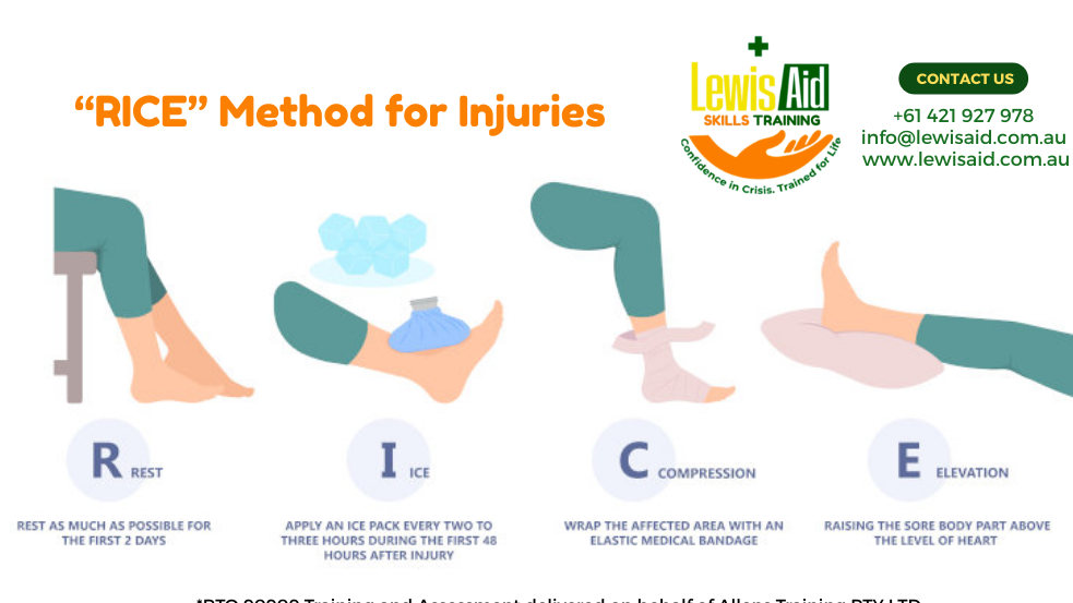 "Sprains and Strains: First Aid Made Simple with RICER"