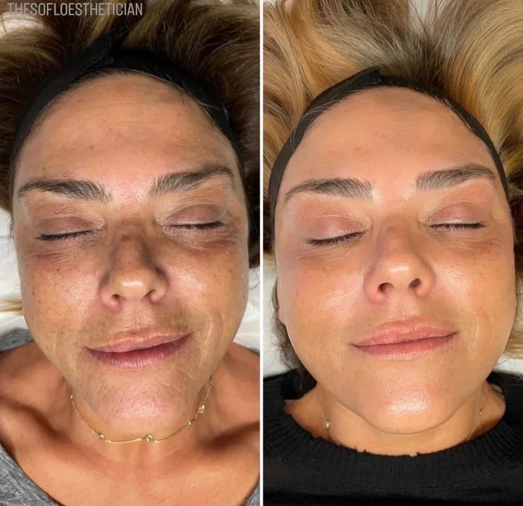 lady with eyelash tint by krista myers at marco island aesthetics