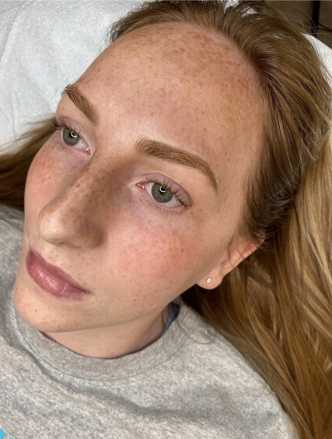 two ladies starring by krista myers at marco island aesthetics
