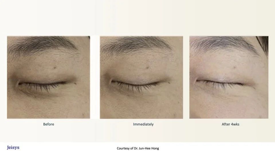 Density B&A Compendium 10.20.25.jpg