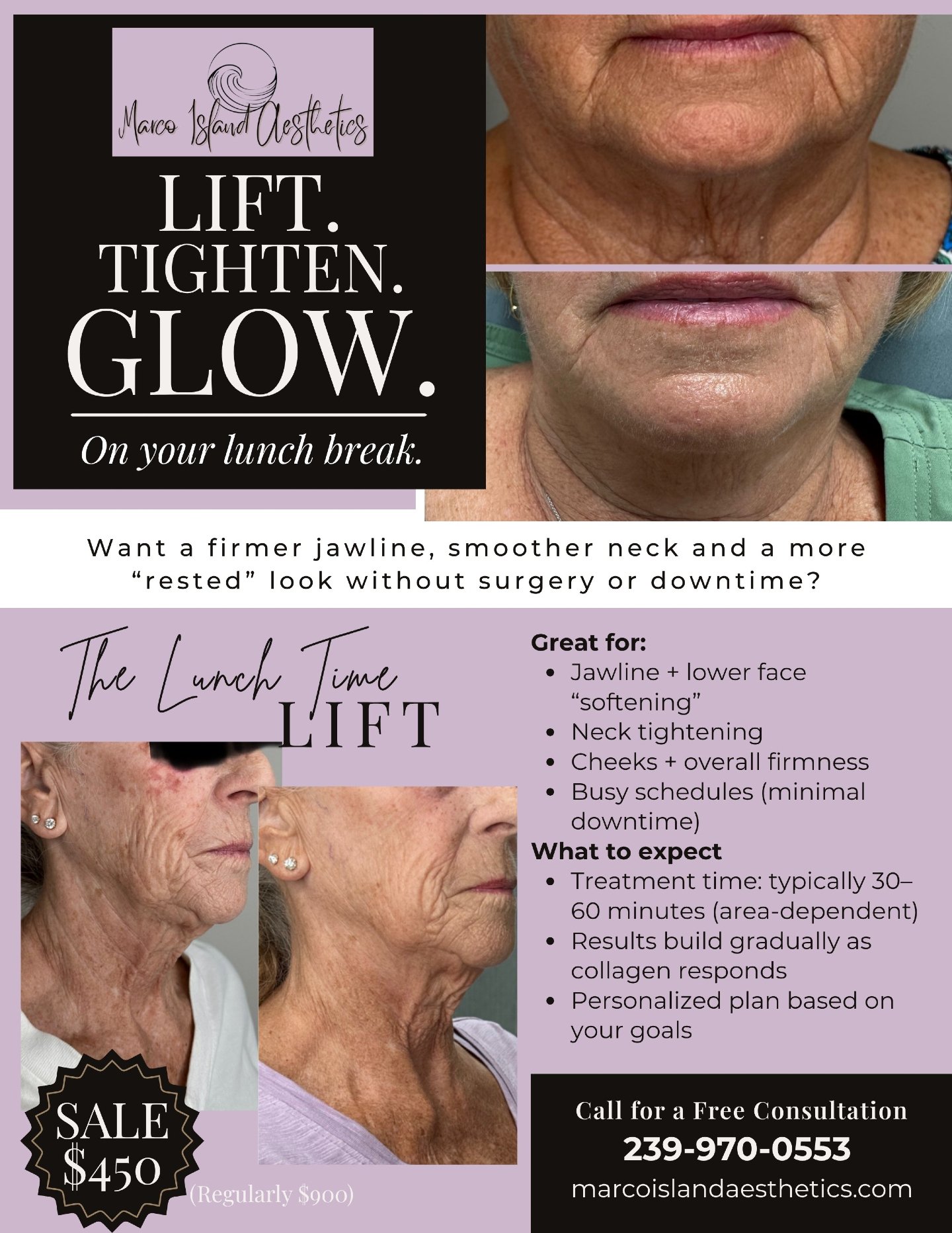 You don&rsquo;t need hours&hellip; just a lunch break.

The Lunch Time Lift is a quick, non-surgical option designed to support smoother, firmer-looking skin over time.

📞 Call  239-970-0553 to book your consultation