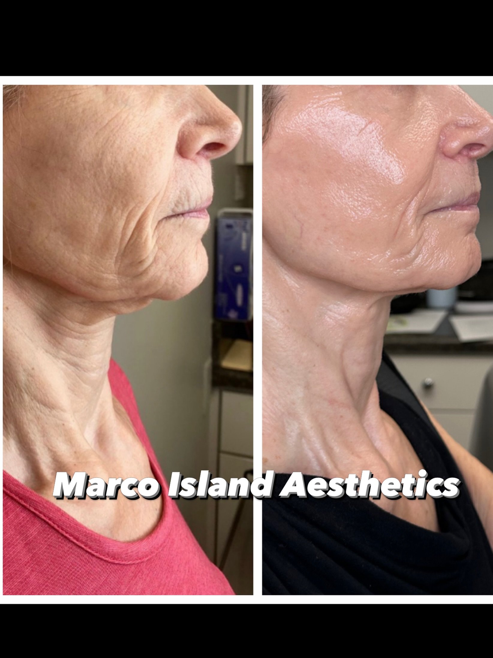 We don&rsquo;t promise results. We deliver them.
Marco Island aesthetics serving Marco Island for 31 years.

Book your appointment today.
Marcoislandaesthetics.com