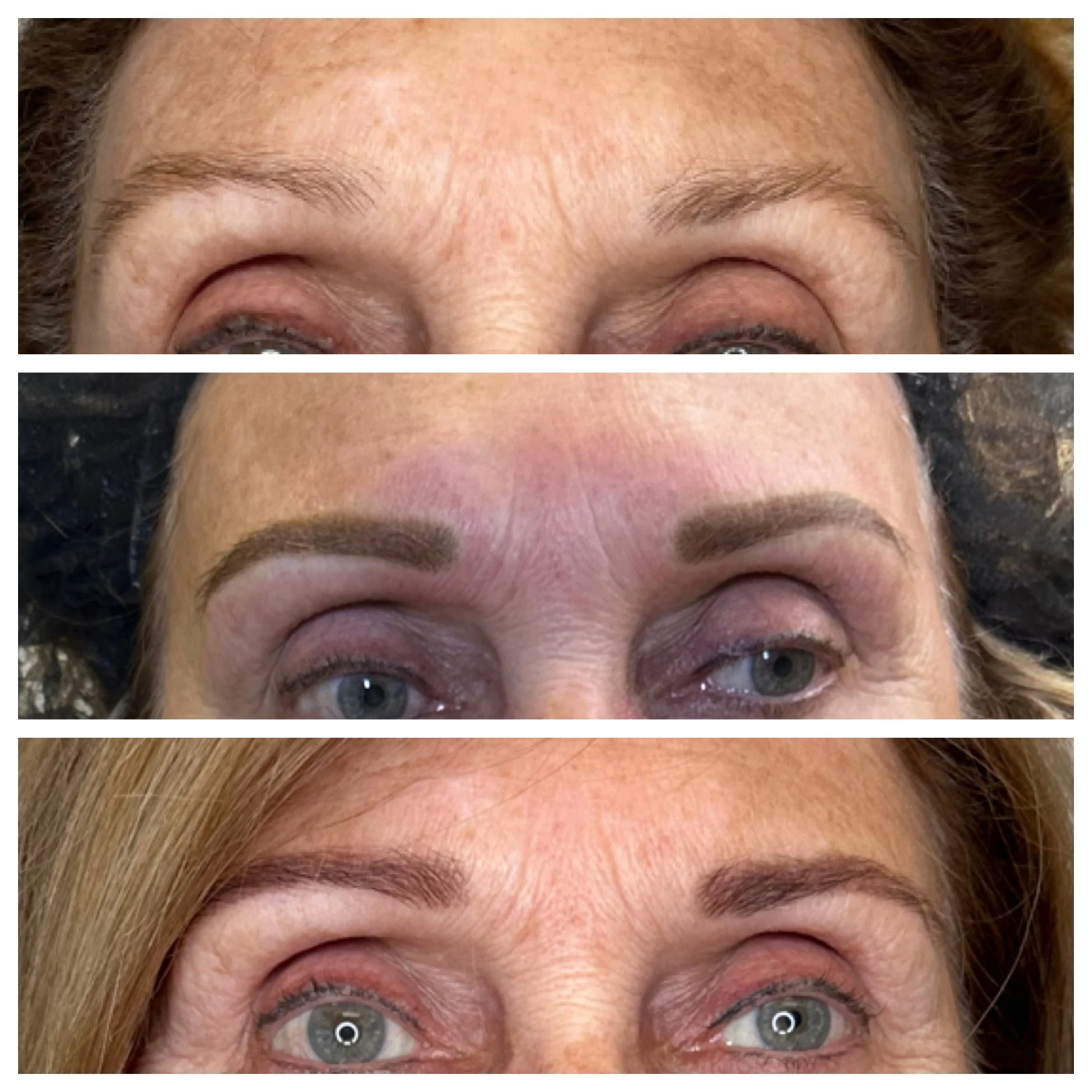 two ladies starring by  krista myers at marco island aesthetics  