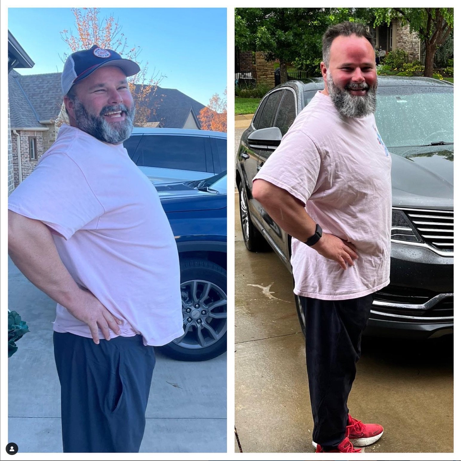 Side-by-side comparison of a man before and after weight loss, standing outdoors next to cars, smiling with hands on hips, wearing a light pink t-shirt and dark pants, with a beard and short hair, in a suburban neighborhood.