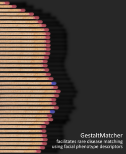 GestaltMatcher