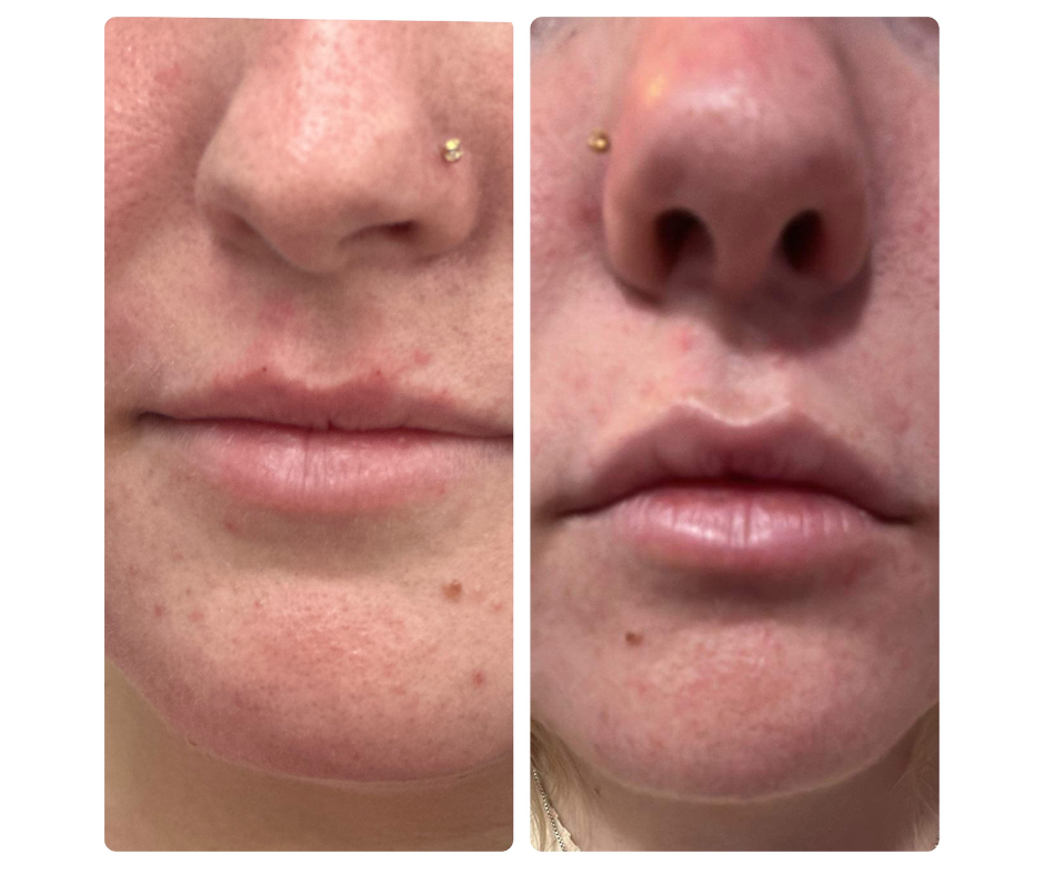 The Aesthetic Studio  Salmon, ID 83467.png