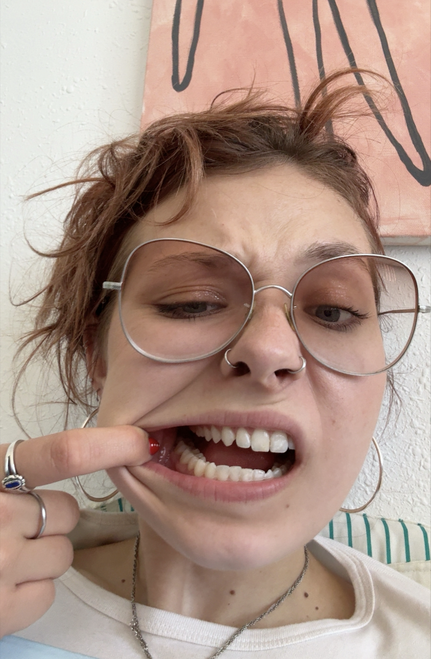 Ooops… I just love to tease a little *insert silly sassy tongue out winking emoji*