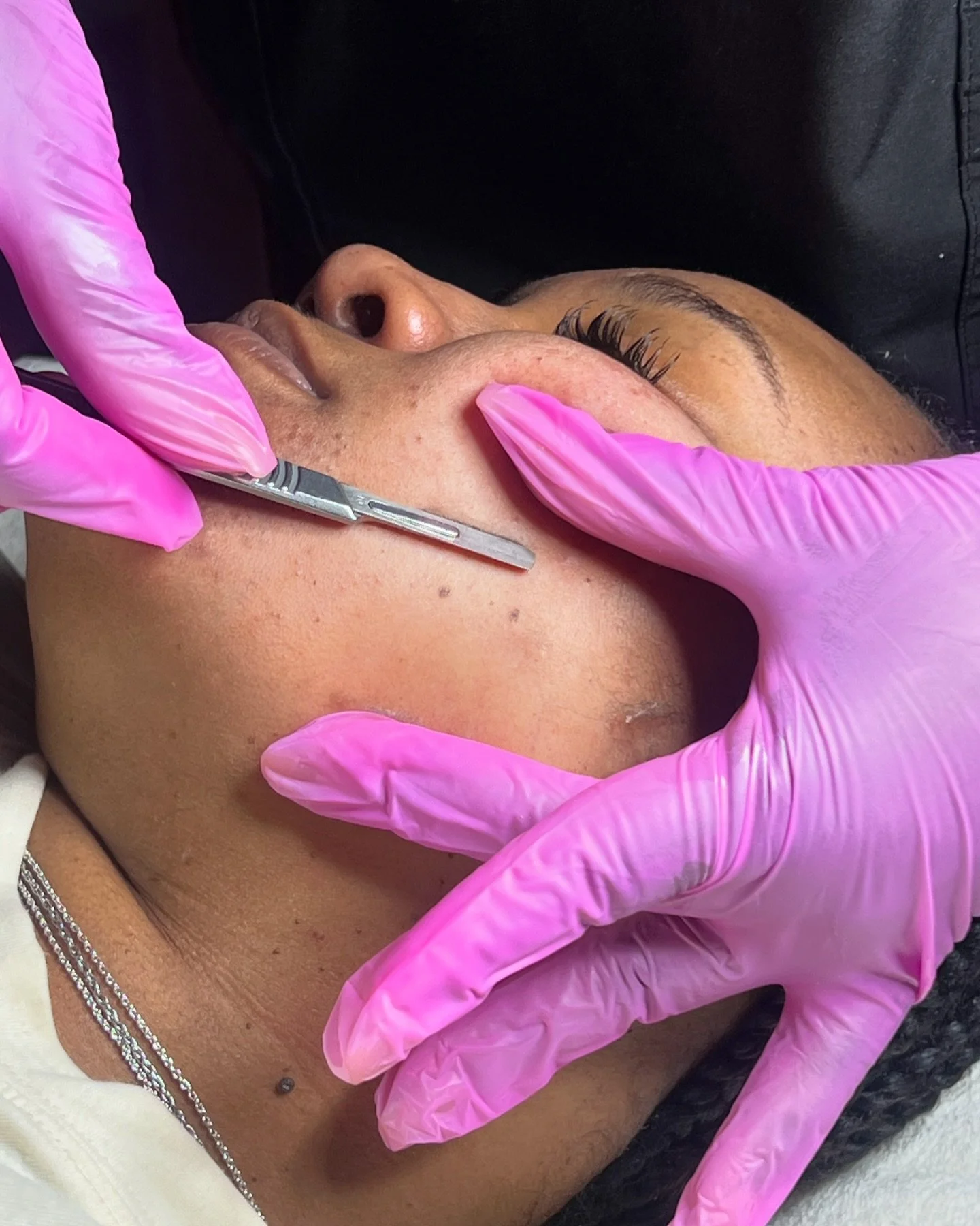 You don&rsquo;t realize how much your skin needs exfoliation until you do it and see the results&hellip;

Book your dermaplane facial to get rid of dead skin and reveal your natural glow ✨

#dermaplaning #dermaplane #dermaplaningfacial #estheticianli