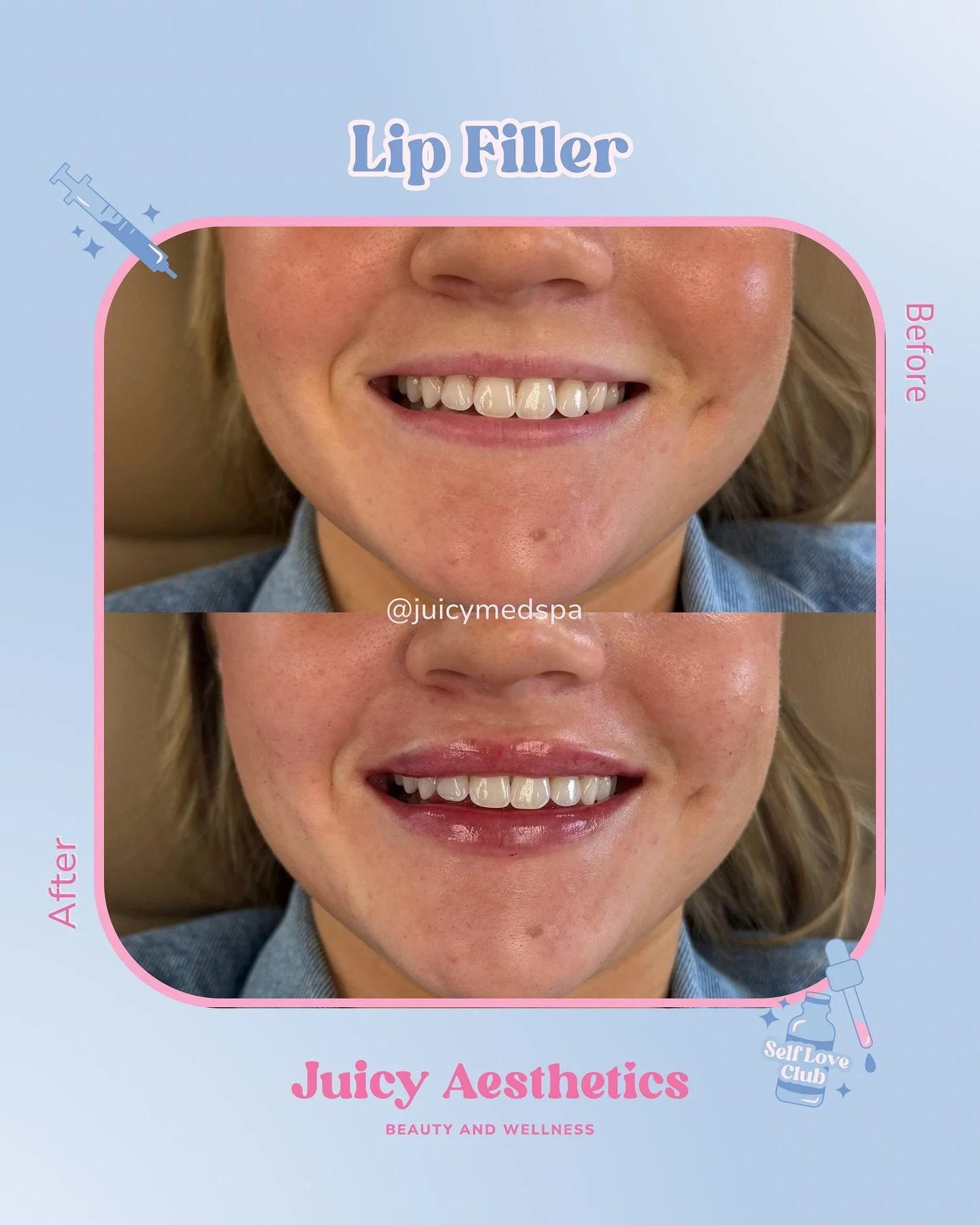 Balanced and enhanced 👄 hydrated and defined lips that still look and feel like YOU ✨ our specialty is natural, juicy results&mdash; never overfilled.

Book before the holiday hustle and bustle begins 👇🏼
juicy.janeapp.com

📍Juicy Aesthetics

A Va
