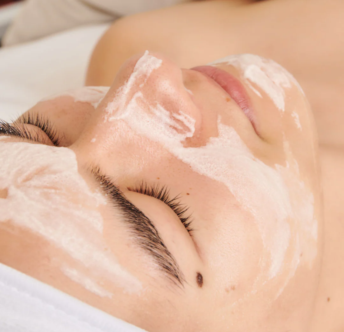 Dermathod O2 Tox Peel treatment foaming on face for exfoliation, oxygenation, and skin renewal | Louloùdi Esthetics