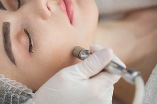 Say goodbye to dull skin and hello to a radiant glow with our microdermabrasion treatment✨✨

Only ONE Monday left 6/30 for our $69 Microdermabrasion facial🧖&zwj;♀️
 
Call 941-266-9090 today to schedule, only a few spots left‼️