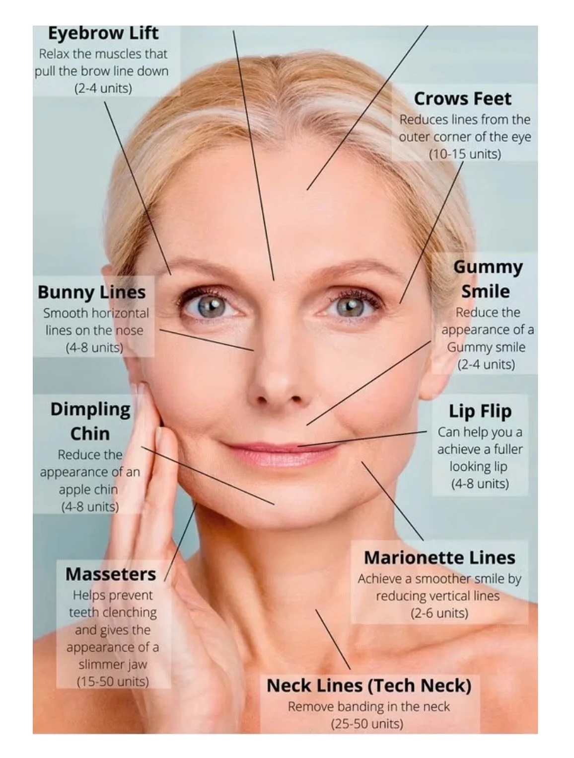 Here&rsquo;s a visual of how many units you may need💉💕

Tox Tuesday ONLY August 19th at RMI Medspa!

$8.99 per unit over 40 units💌

Only two spots left! Call 941-266-9090 or email rmimedspa@gmail.com to book.