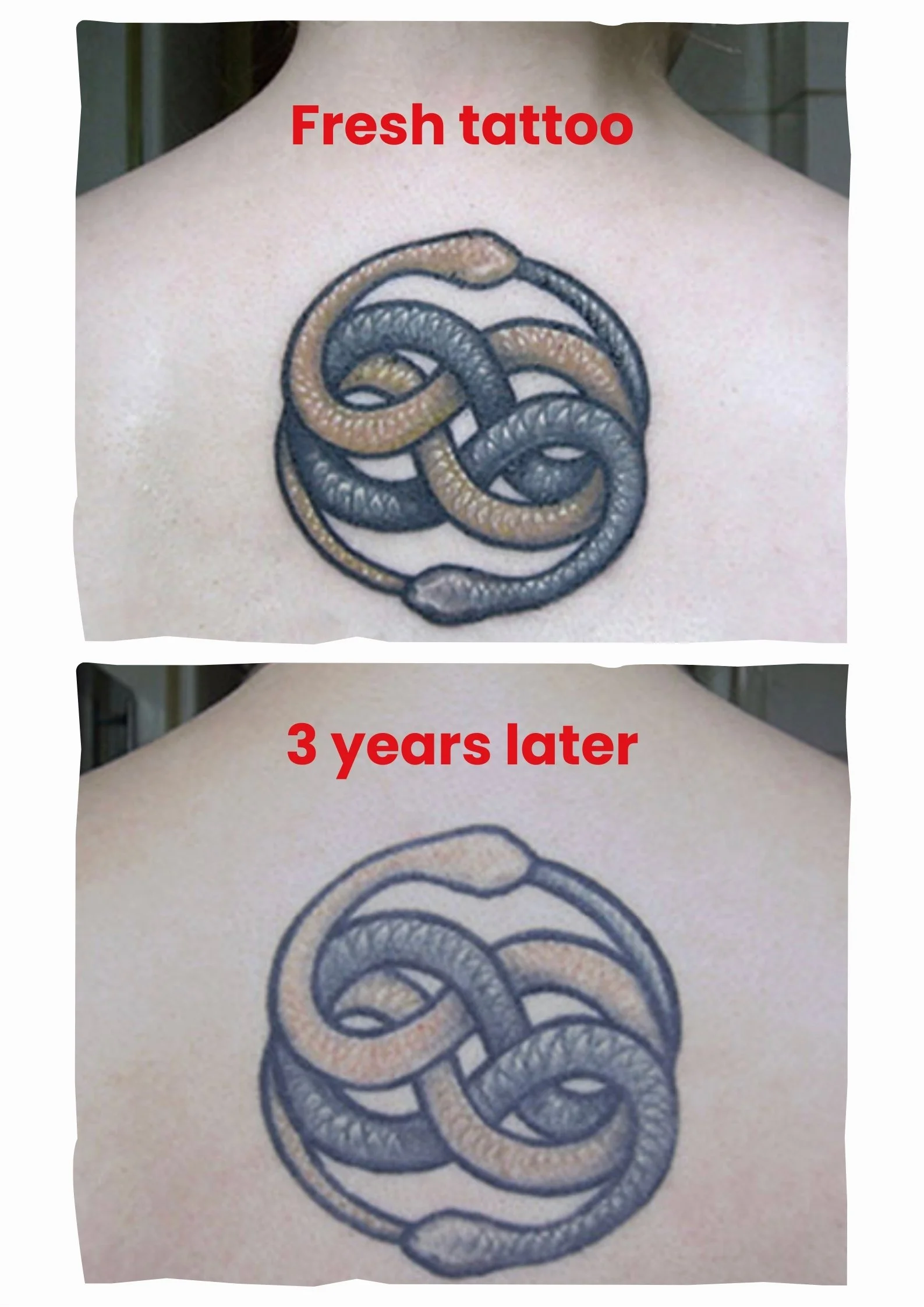 Aftercare and Longevity