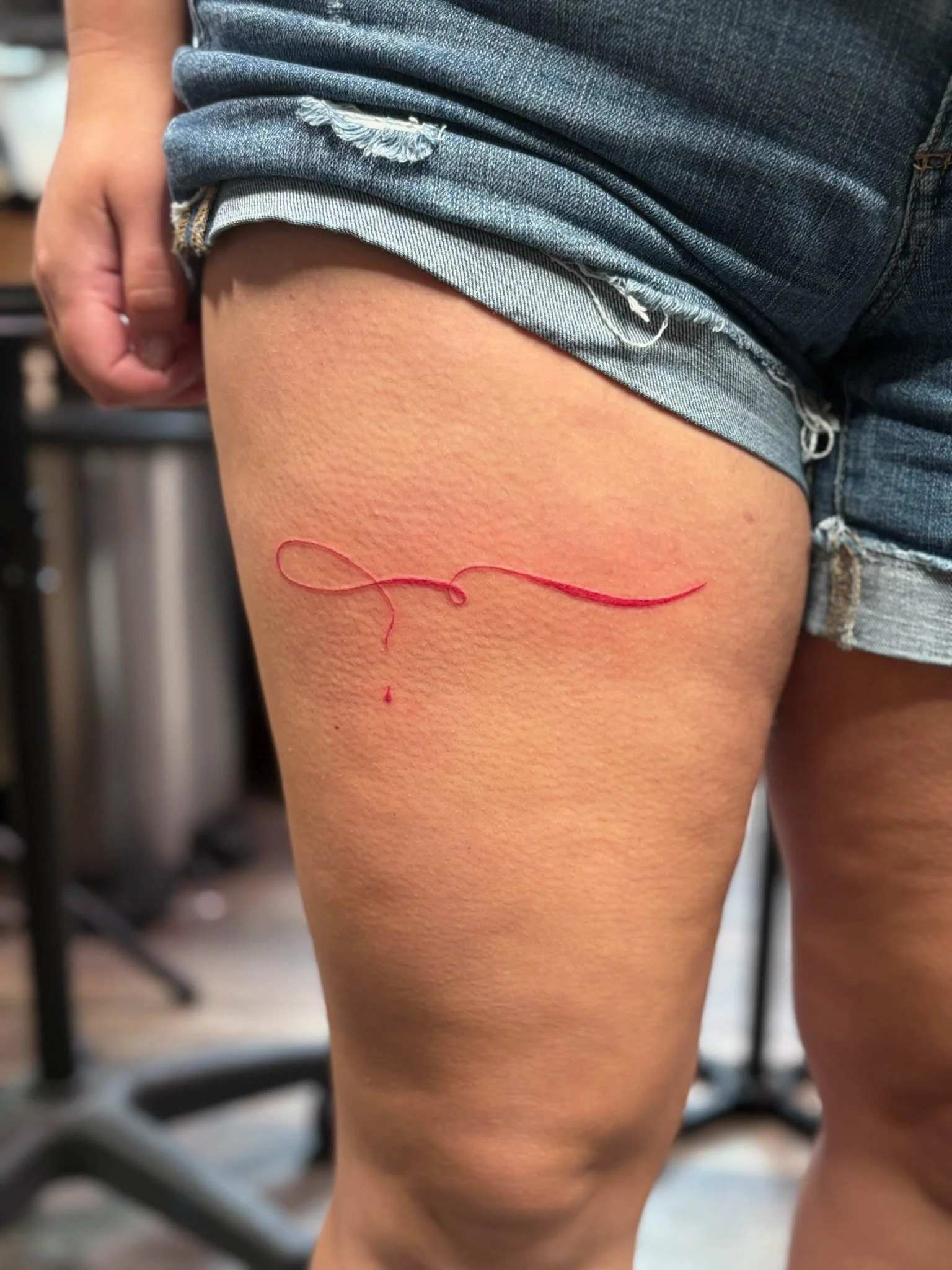 A person's thigh with a small, recent cut stitched with red thread.