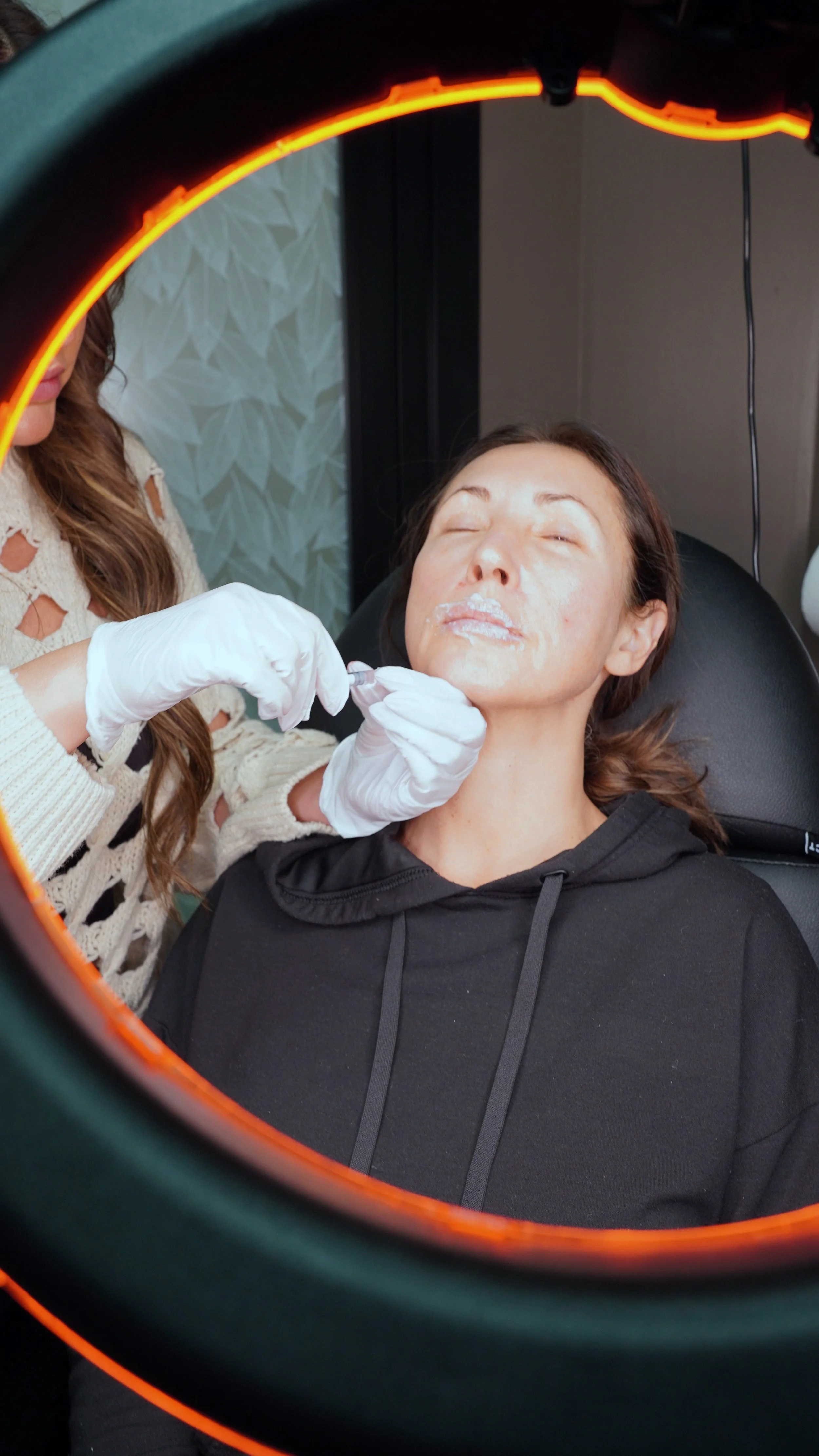 Skin texture improvement treatment consultation Loveland CO.jpg