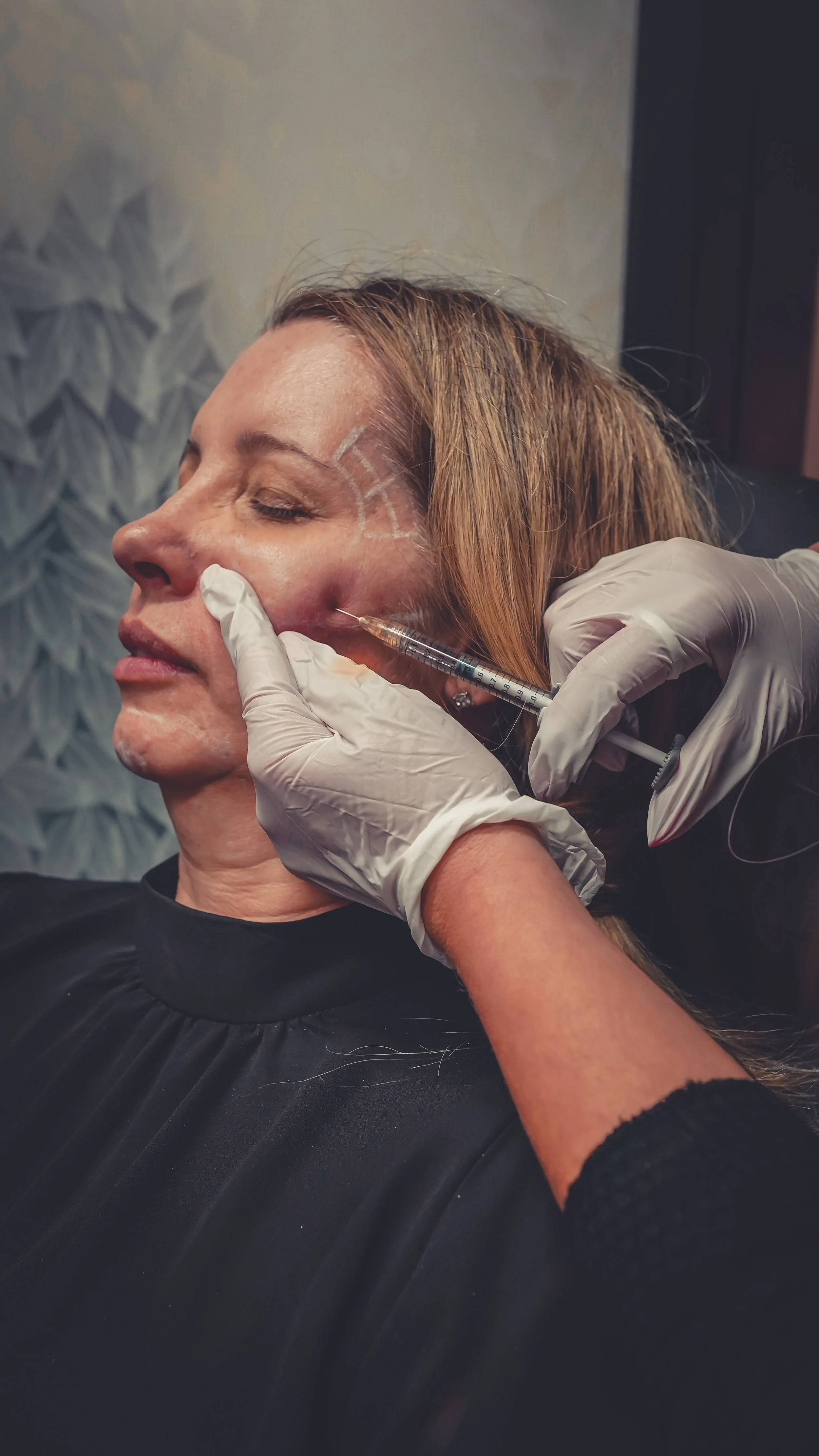 Facial balancing filler treatment.jpeg