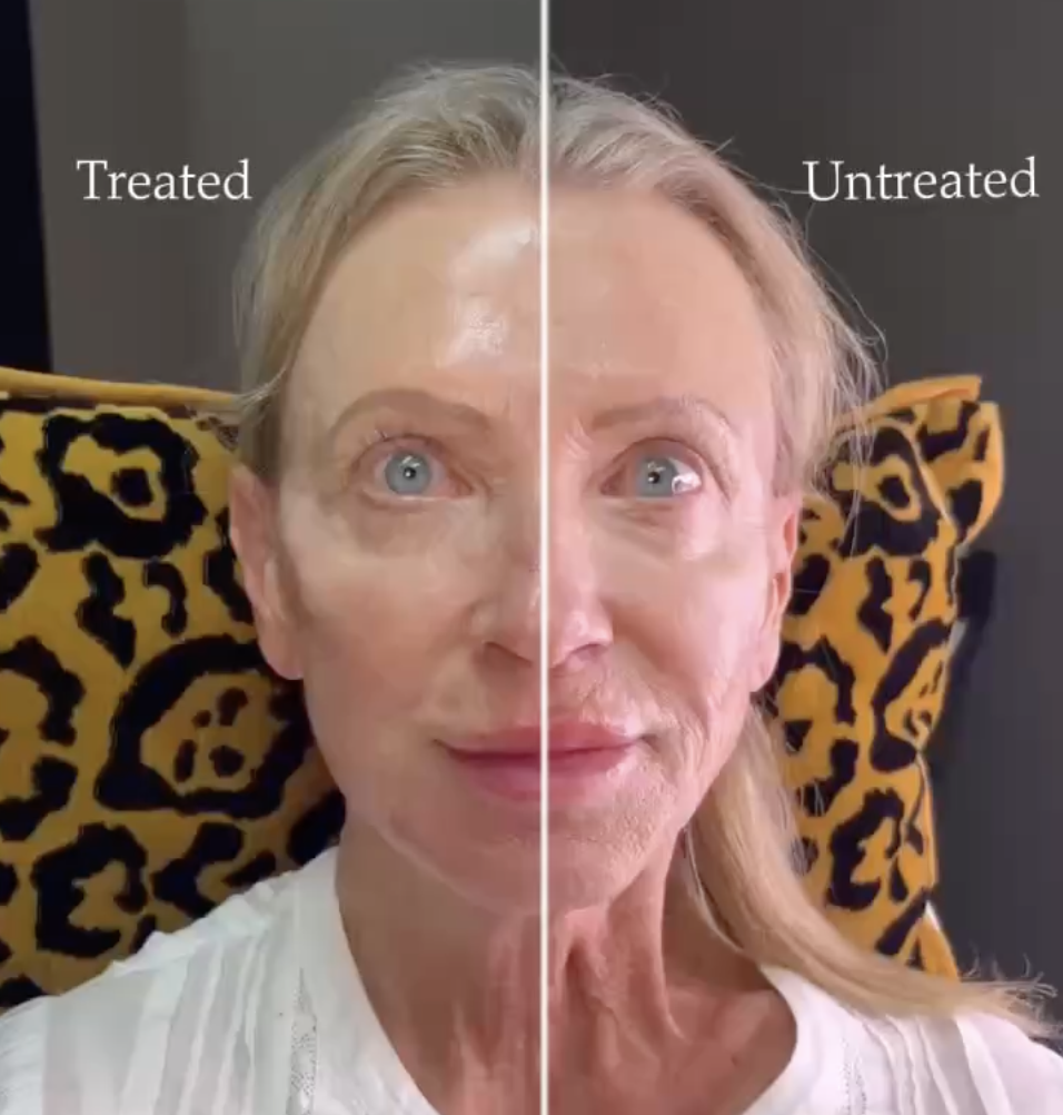 Injectable treatments in Loveland CO.png