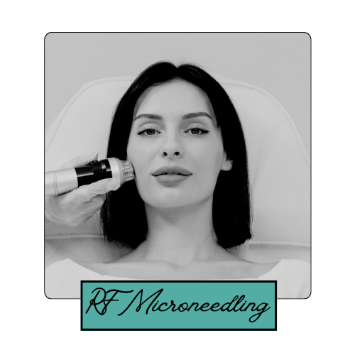 Medspa in Loveland, CO 80537 l RF Microneedling Near Me