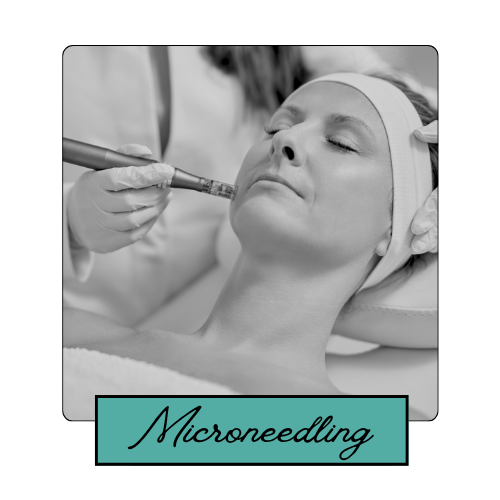 Medspa in Loveland, CO 80537 l Microneedling Near Me.png