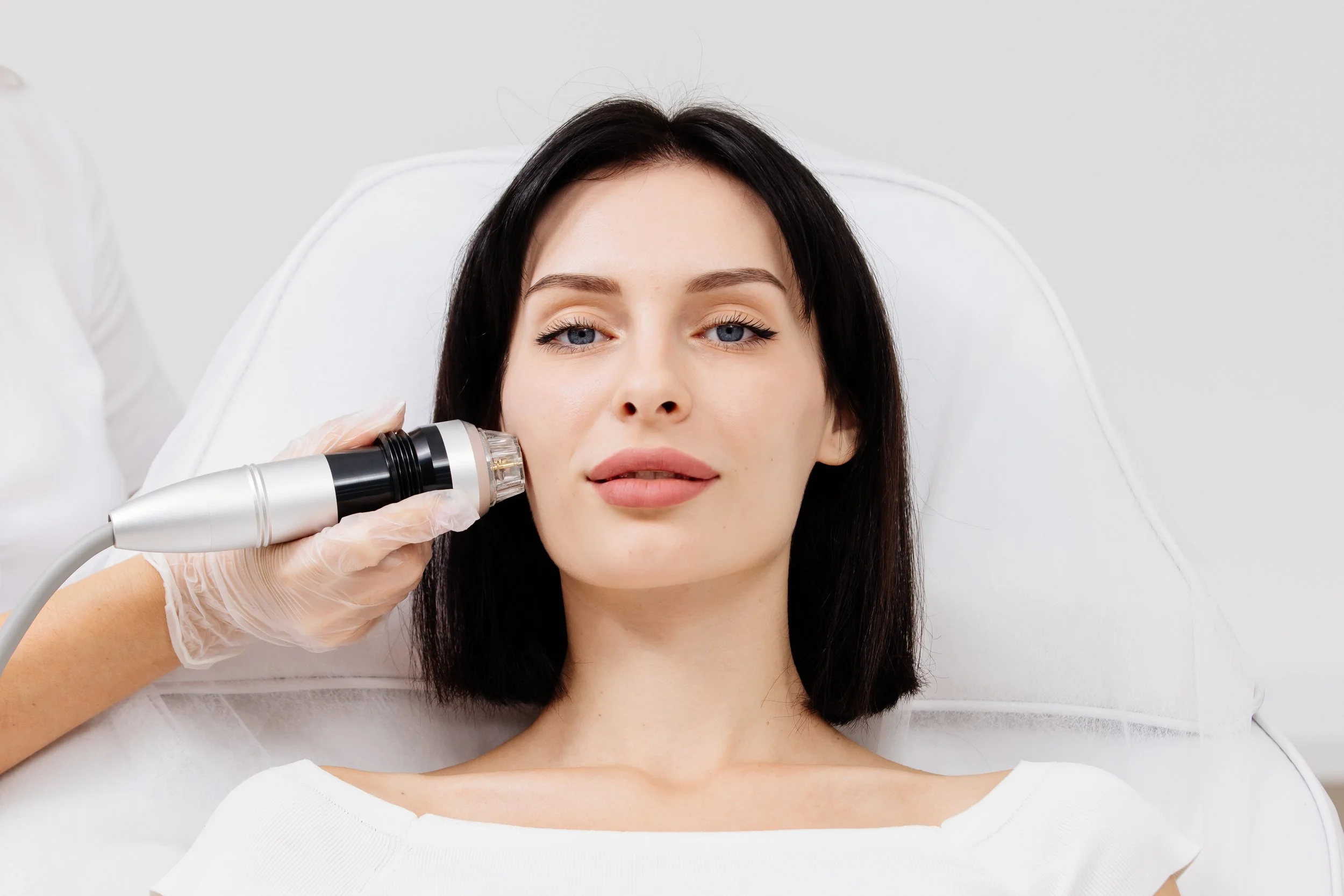 Medspa in Loveland, CO 80537 l RF Microneedling Near Me