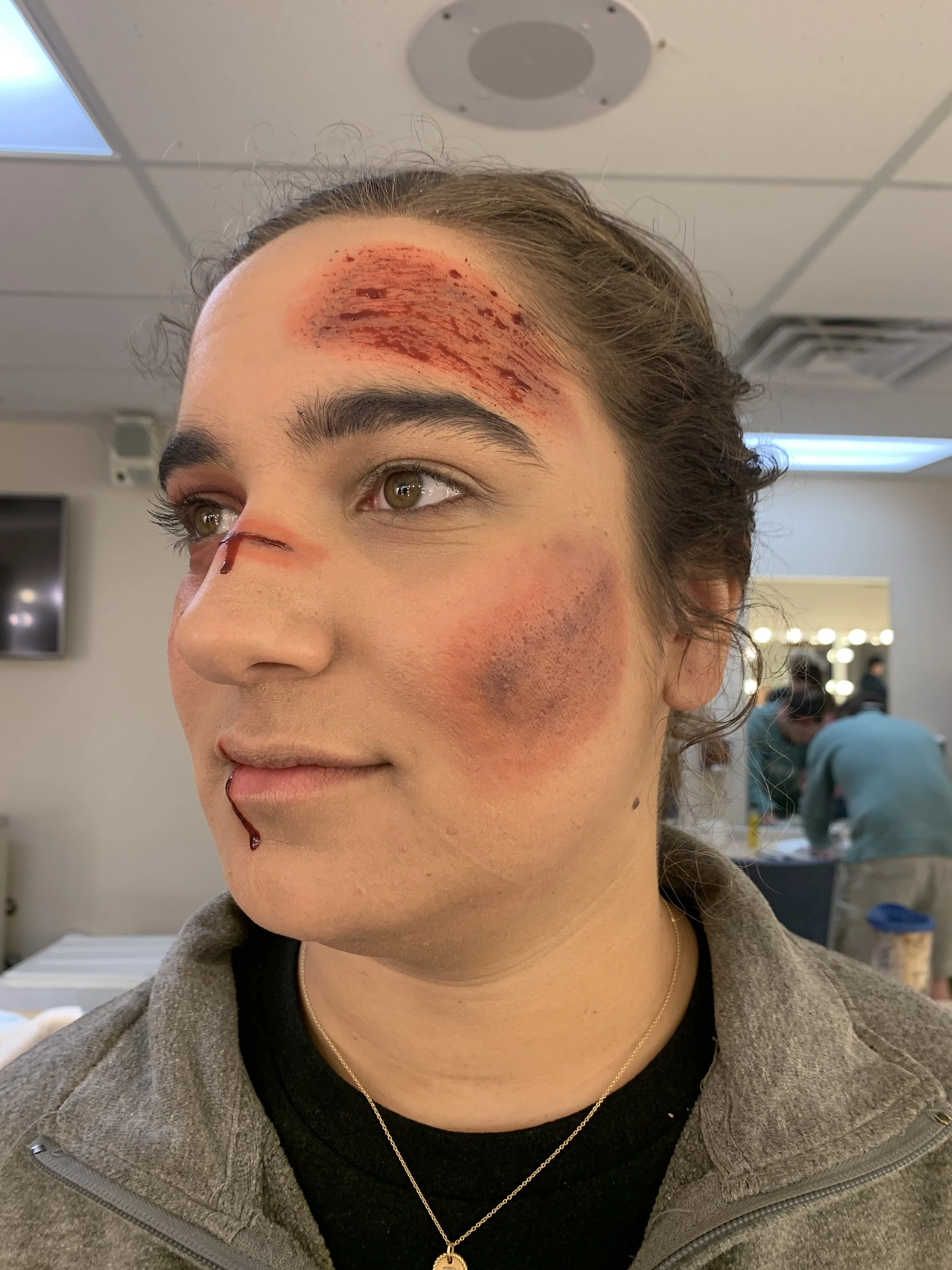 Wound three quarter left.jpg