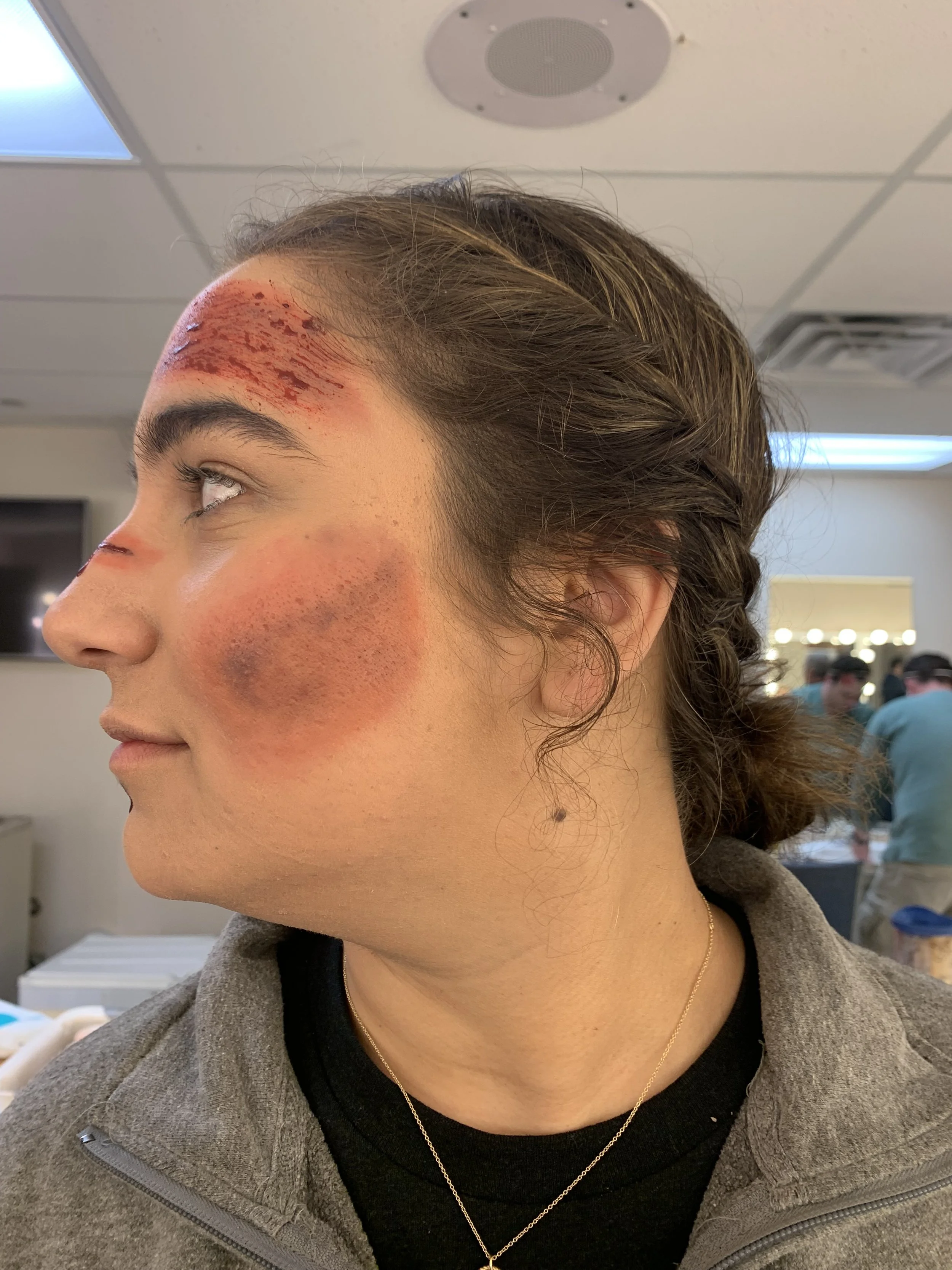 Wound Profile Left.jpg