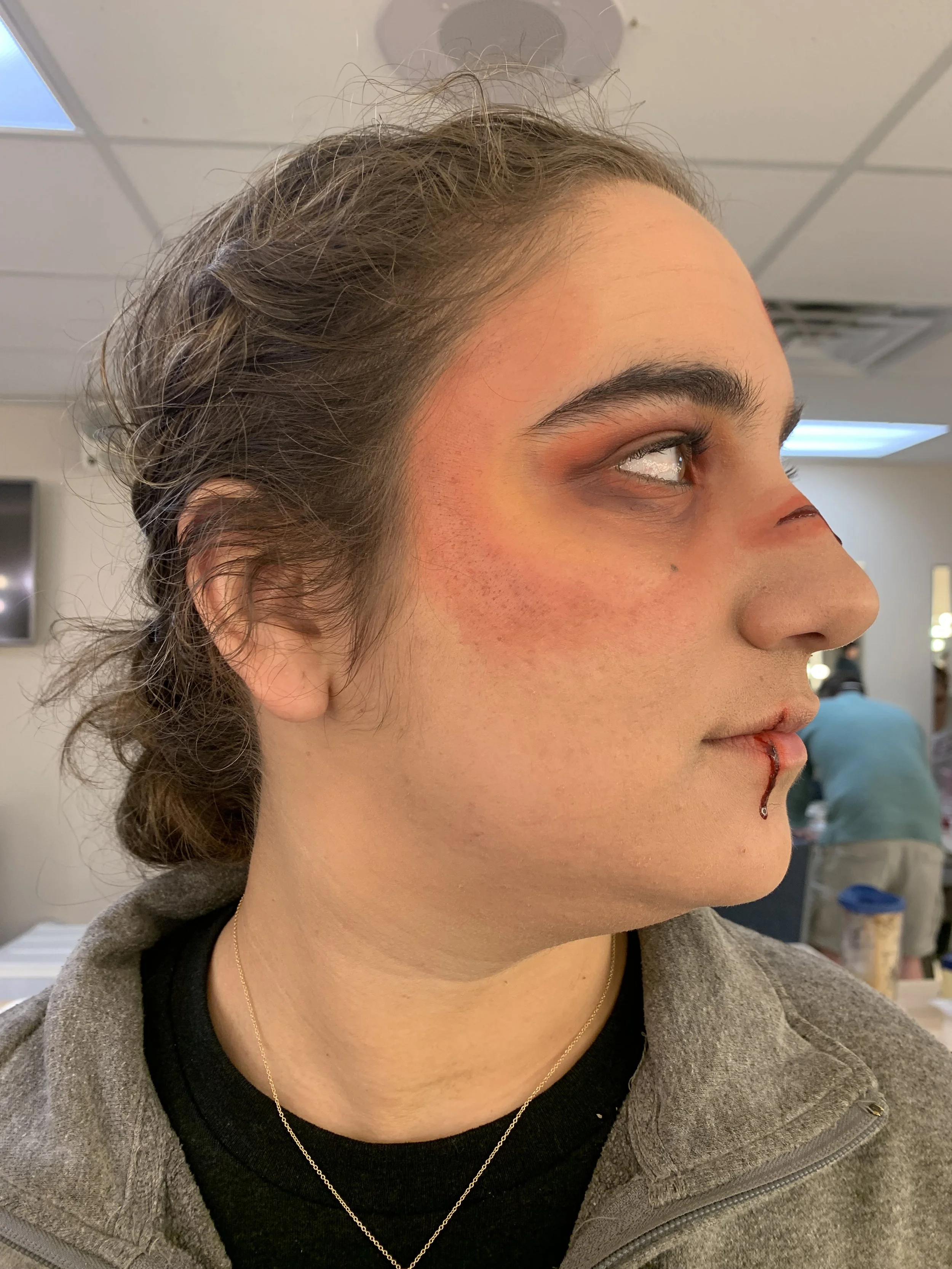 Wound Profile Right.jpg