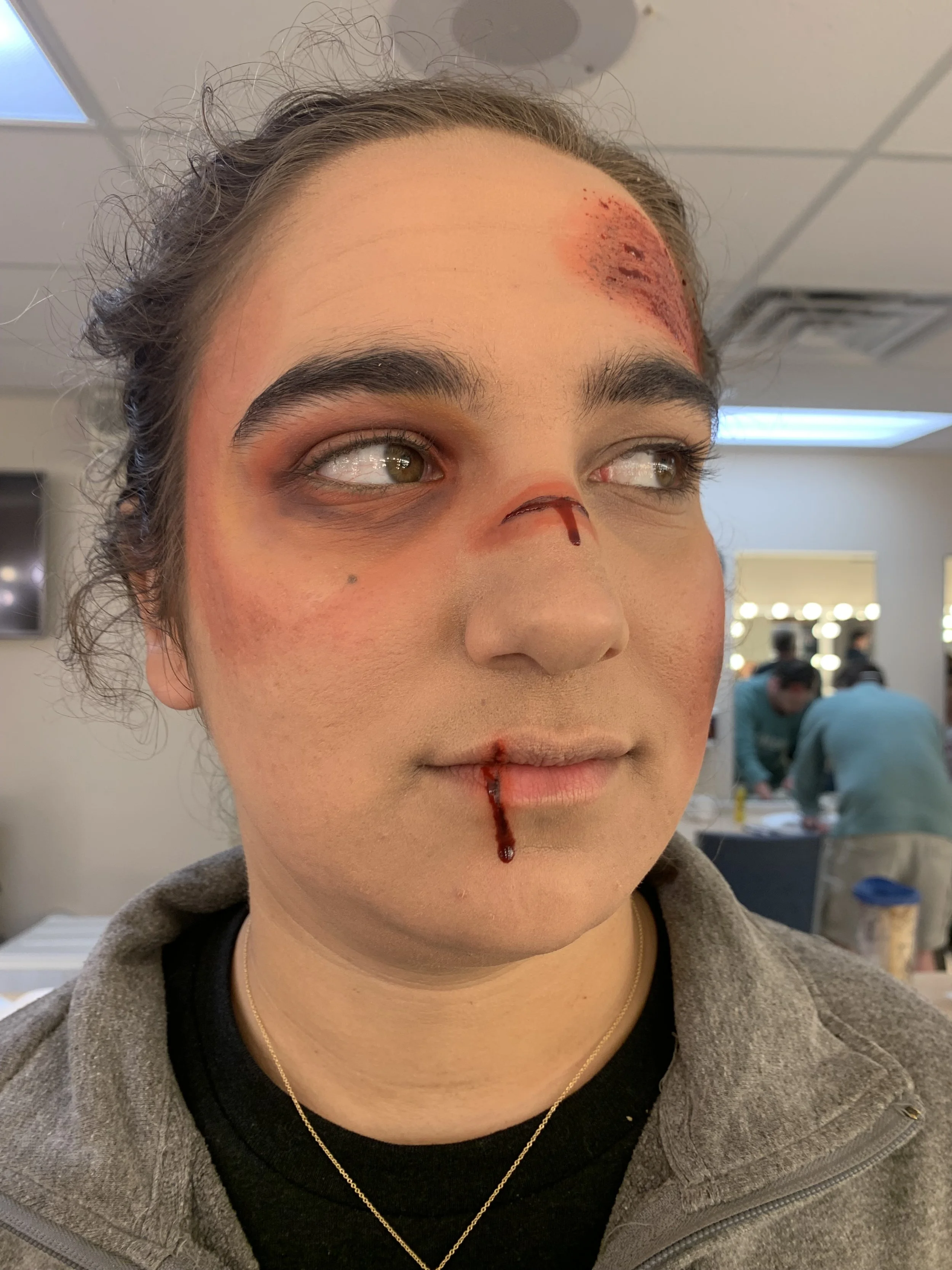 Wound three quarter right.jpg