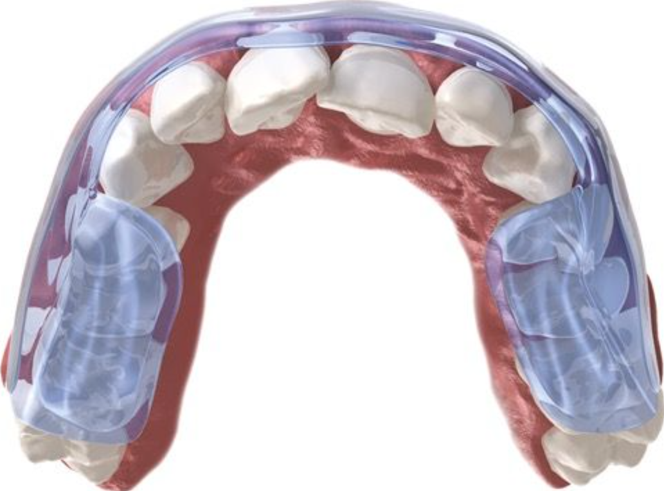 Aqualizer self-adjusting oral splint fit.png