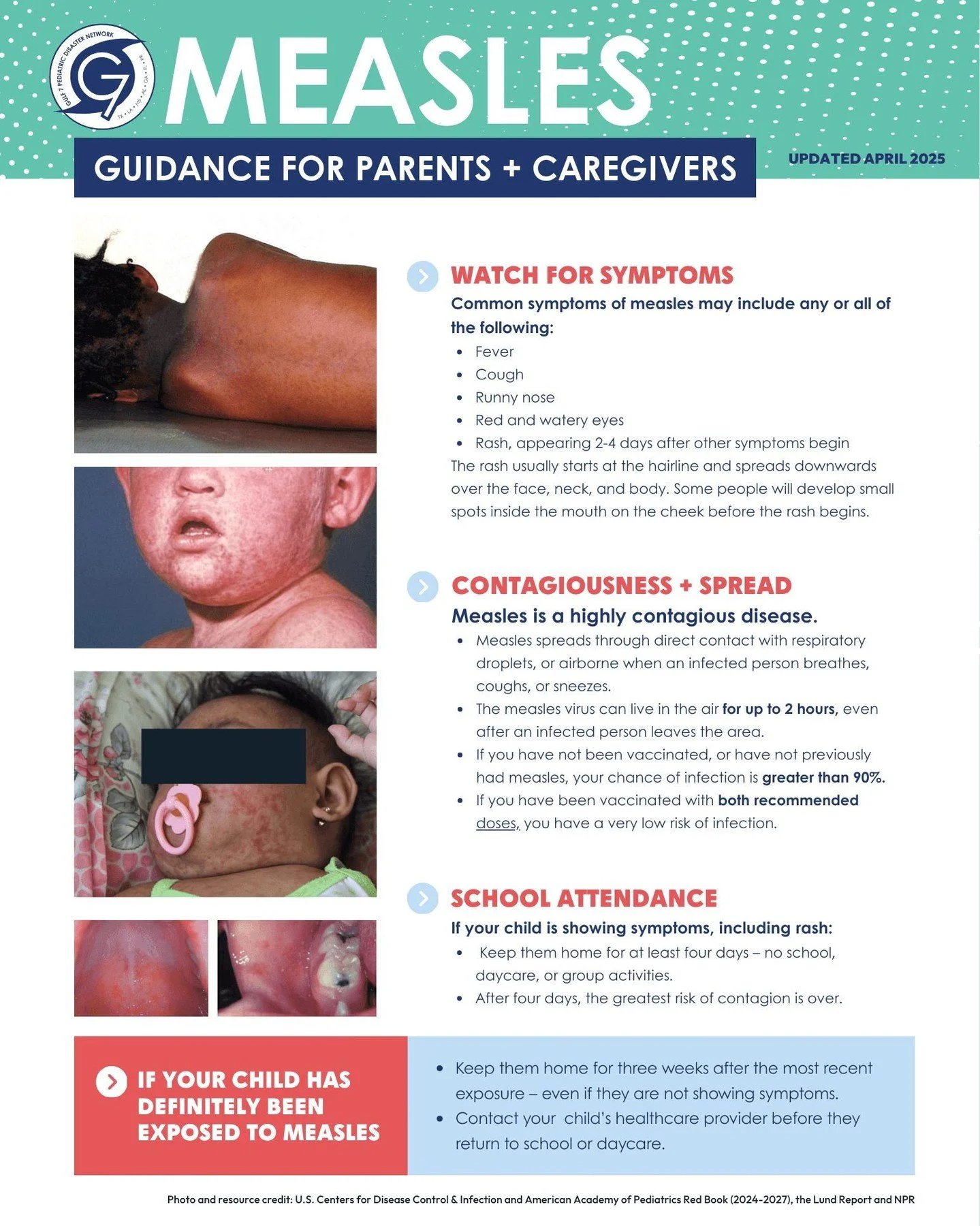 😱🦠 The CDC reports 171 confirmed* measles cases in the U.S. as of Jan 13, 2026. Stay informed and protect your family. 

Learn how to spot symptoms and prevent spread: https://linktr.ee/gulf7.pdn 

https://www.cdc.gov/measles/data-research/index.ht