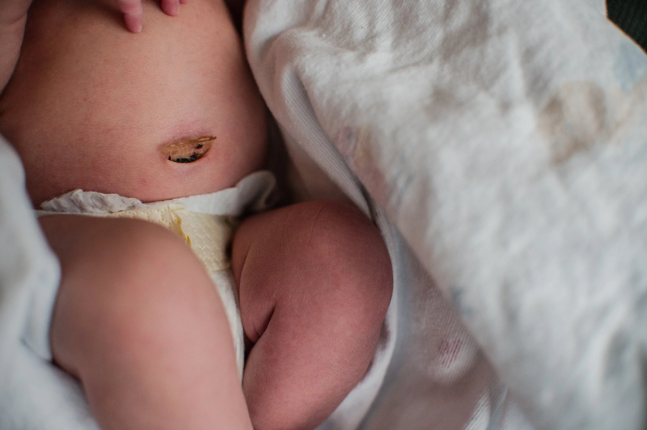 Charlottesville, Virginia Fresh 48 hospital session — candid newborn photo moments captured in candid newborn photo moments captured in baby’s first 48 hours with Erin E. Gallagher Photography.
