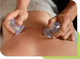 A Partnered Cupping Workshop with Sara LeBeau from Ebb and Flow BodyWork